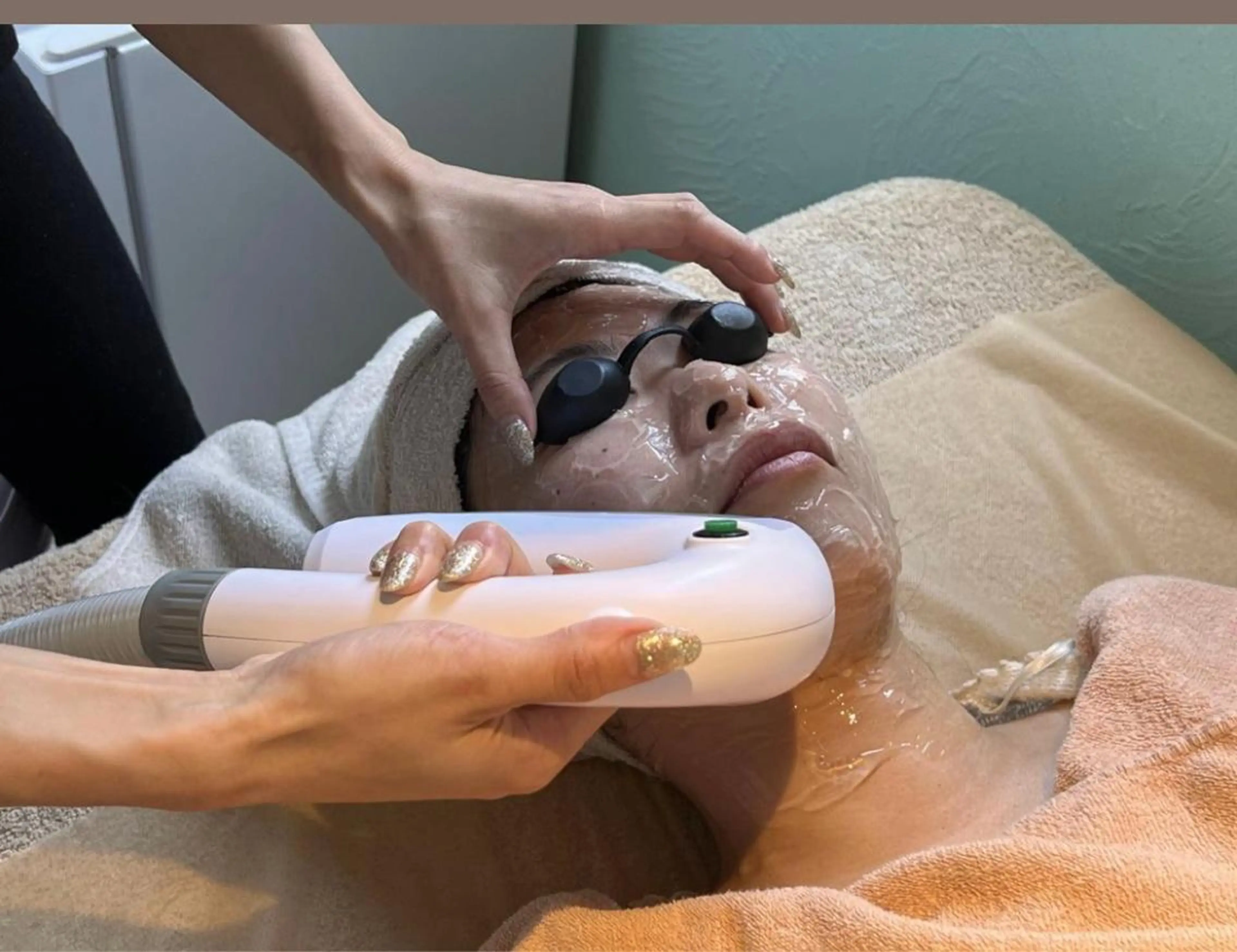 毛穴、角質スッキリ‼ブラックフェイシャル☆5回コースの写真