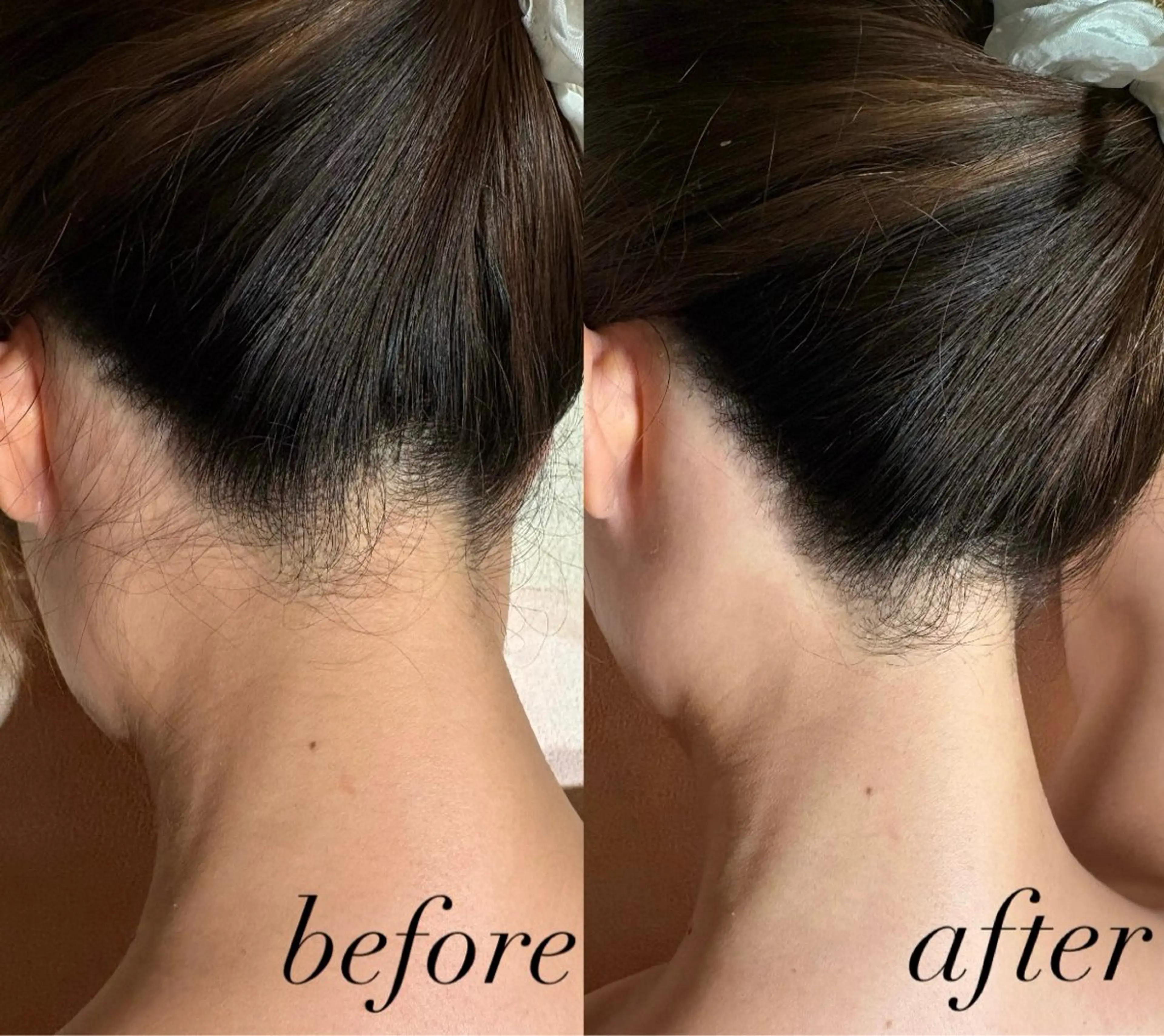 ヘアアレンジ 脱毛 Ricerca ビューティーサロンのエステ・リラクイメージ