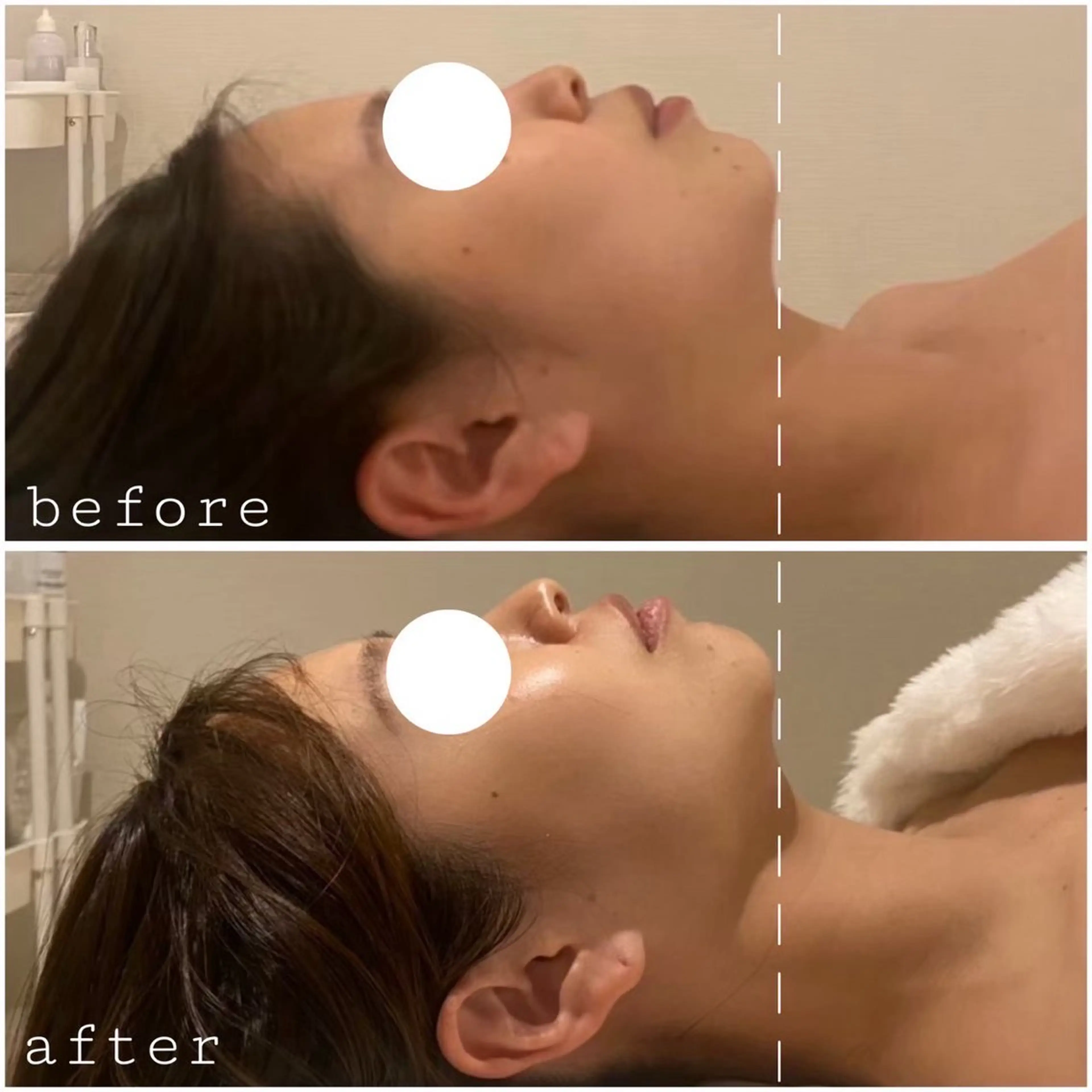 Lib Charm 北本結愛のエステ・リラクイメージ