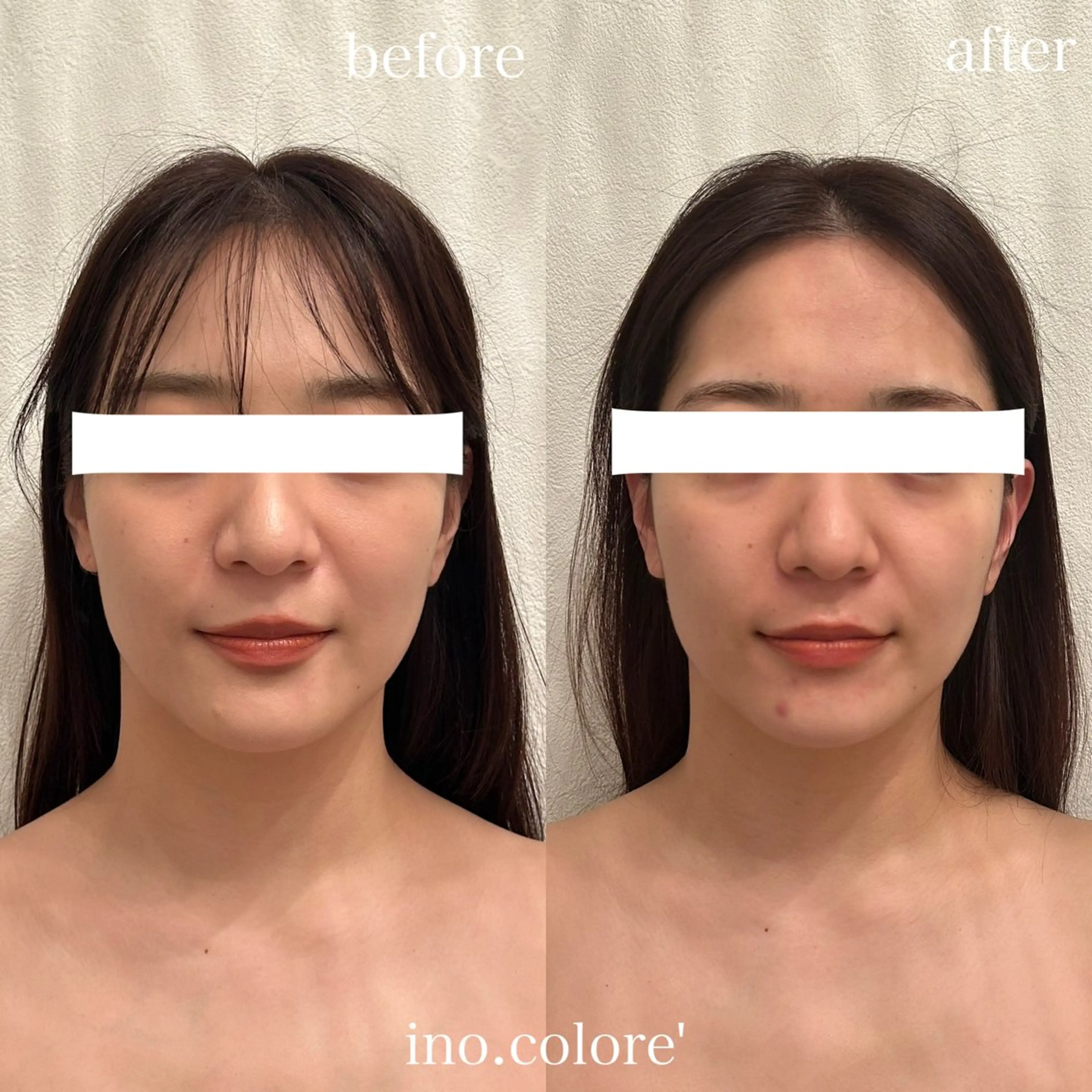 エステサロンino.colore'所属・小顔サロン ino.coloreのエステ・リラクイメージ