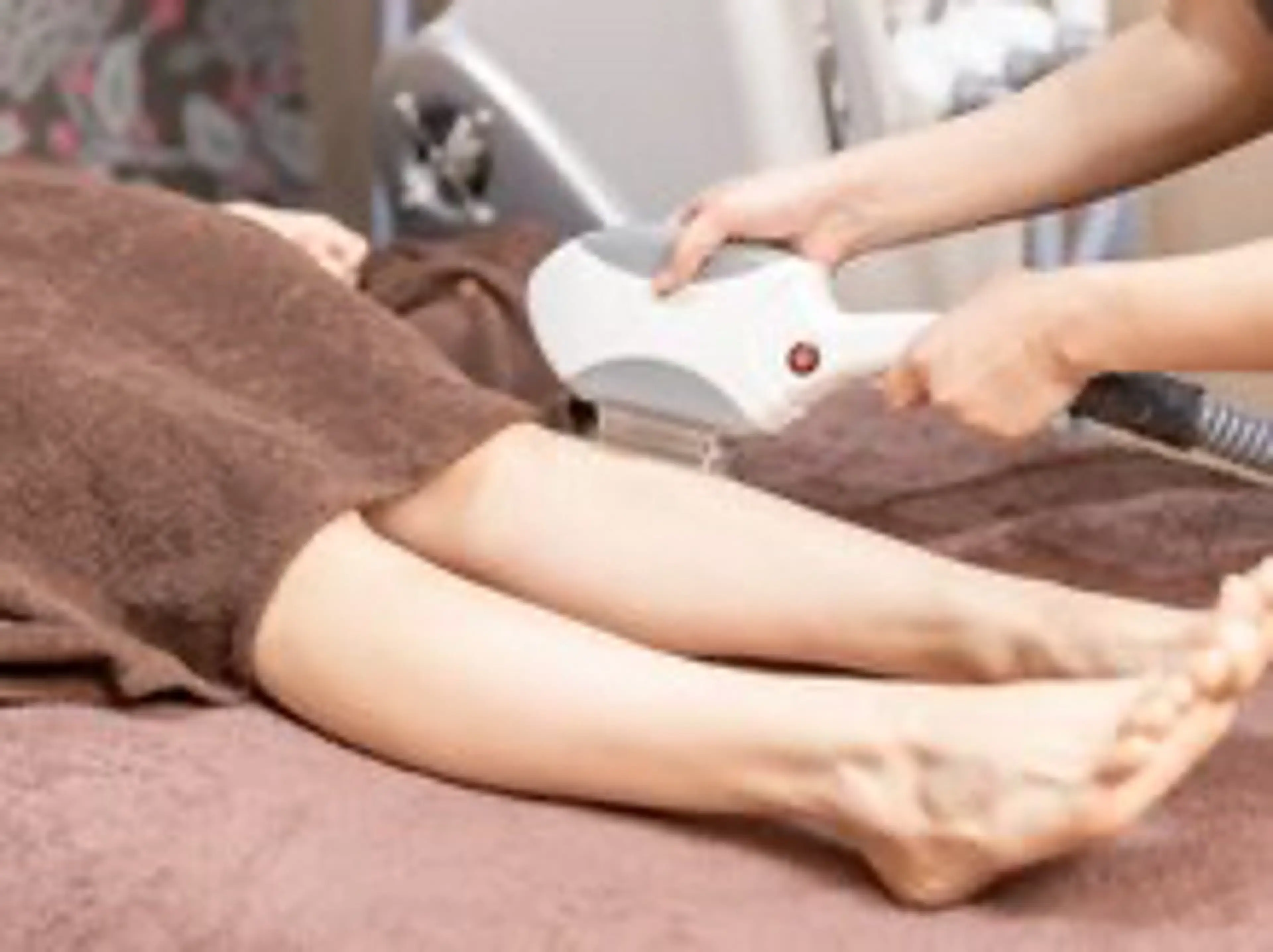 光脱毛全身【女性のみ】顔＋VIO込み！の写真