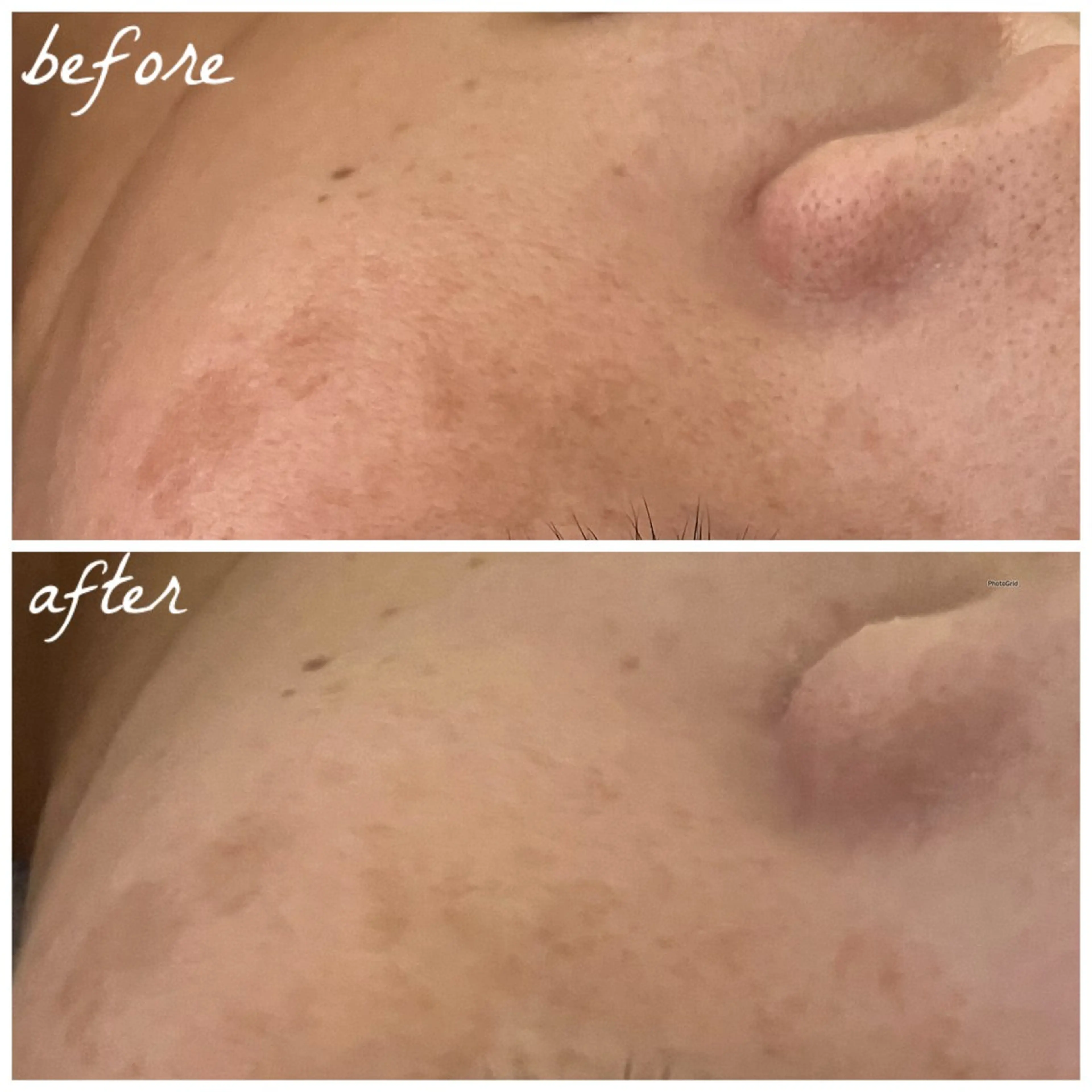 メンズ エステ メナード岐阜茜部 杉浦のエステ・リラクイメージ