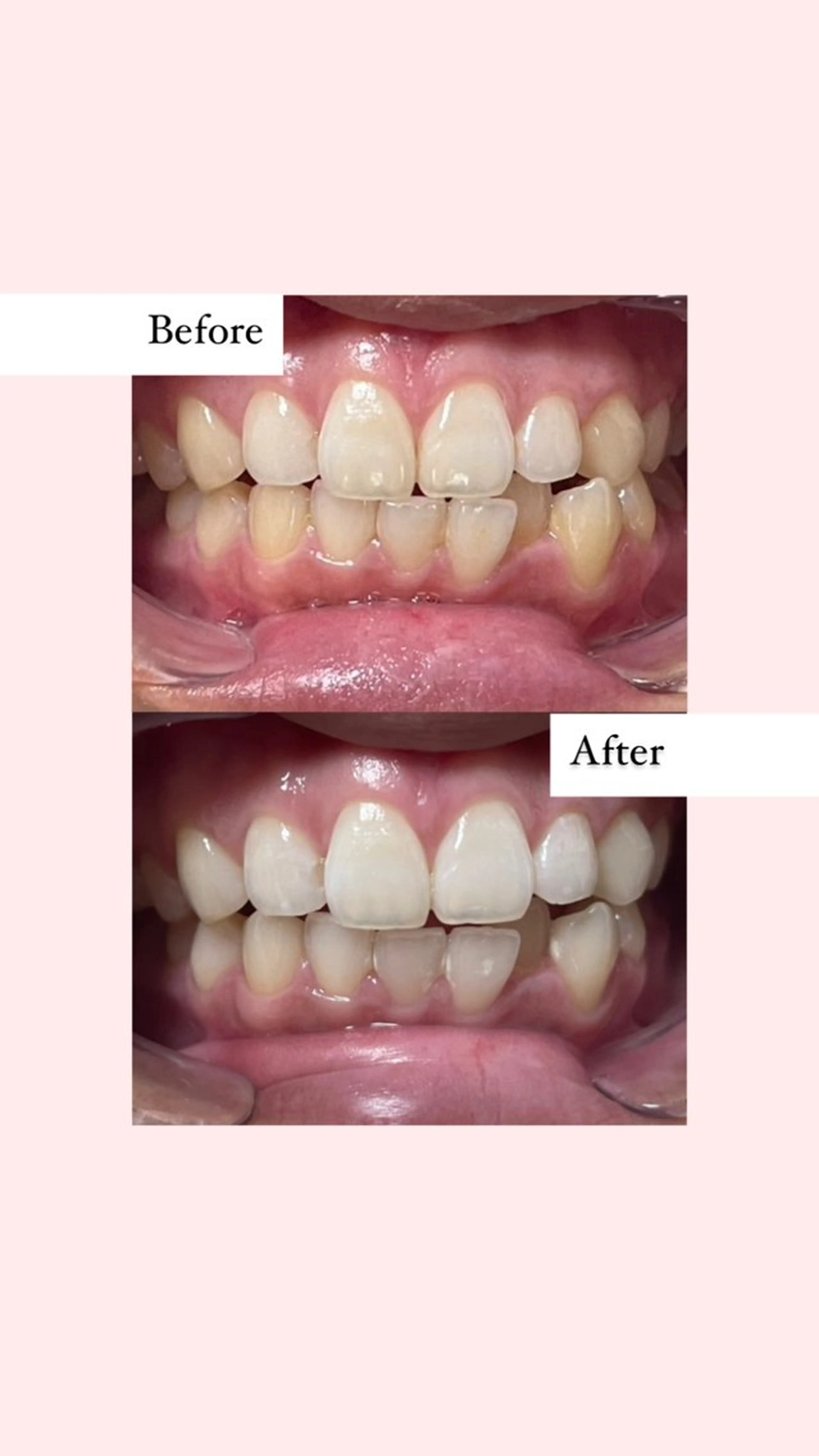 ホワイトニングサロン nybeのその他イメージ