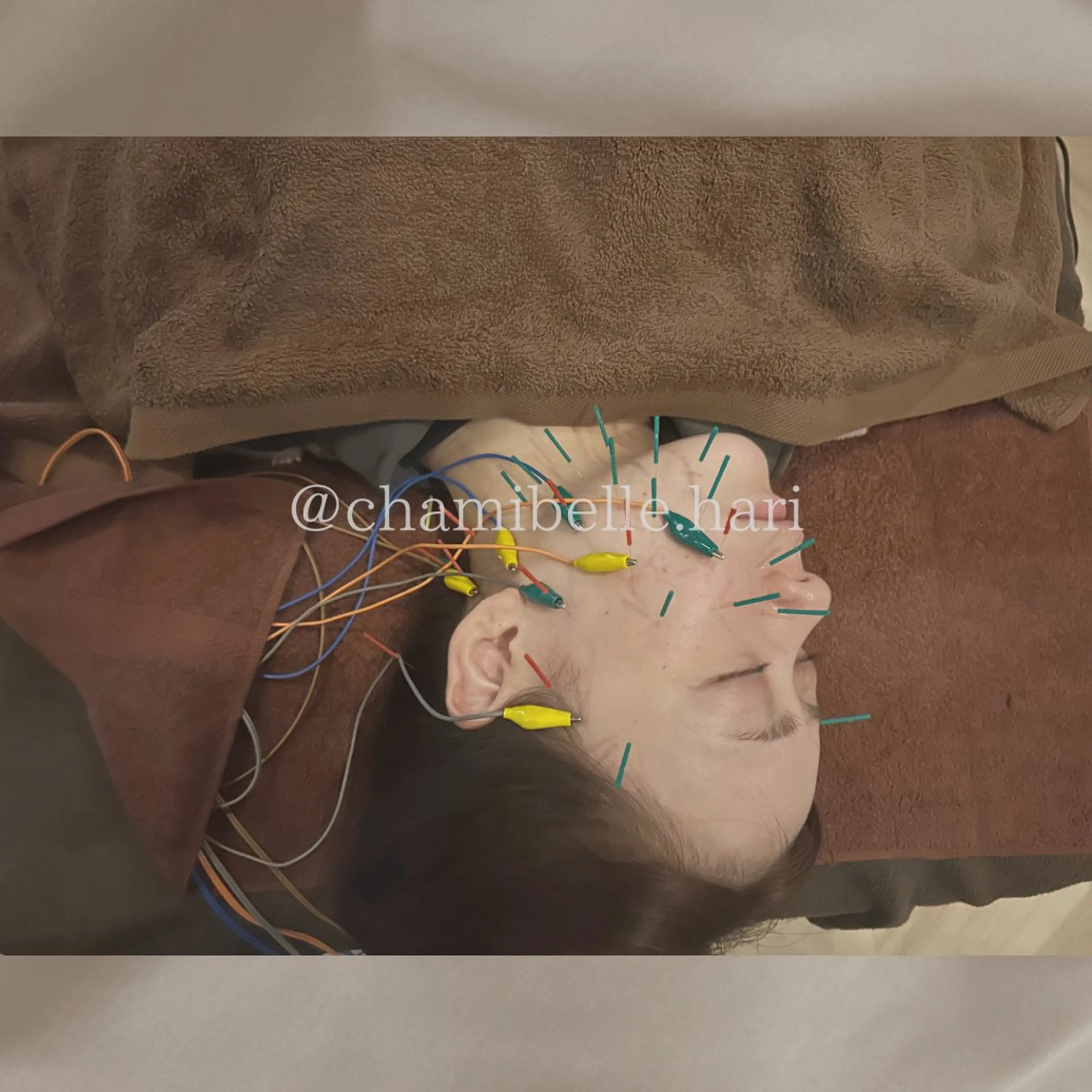 エステ リラク 美容鍼灸サロン Chamibelleのエステ・リラクイメージ