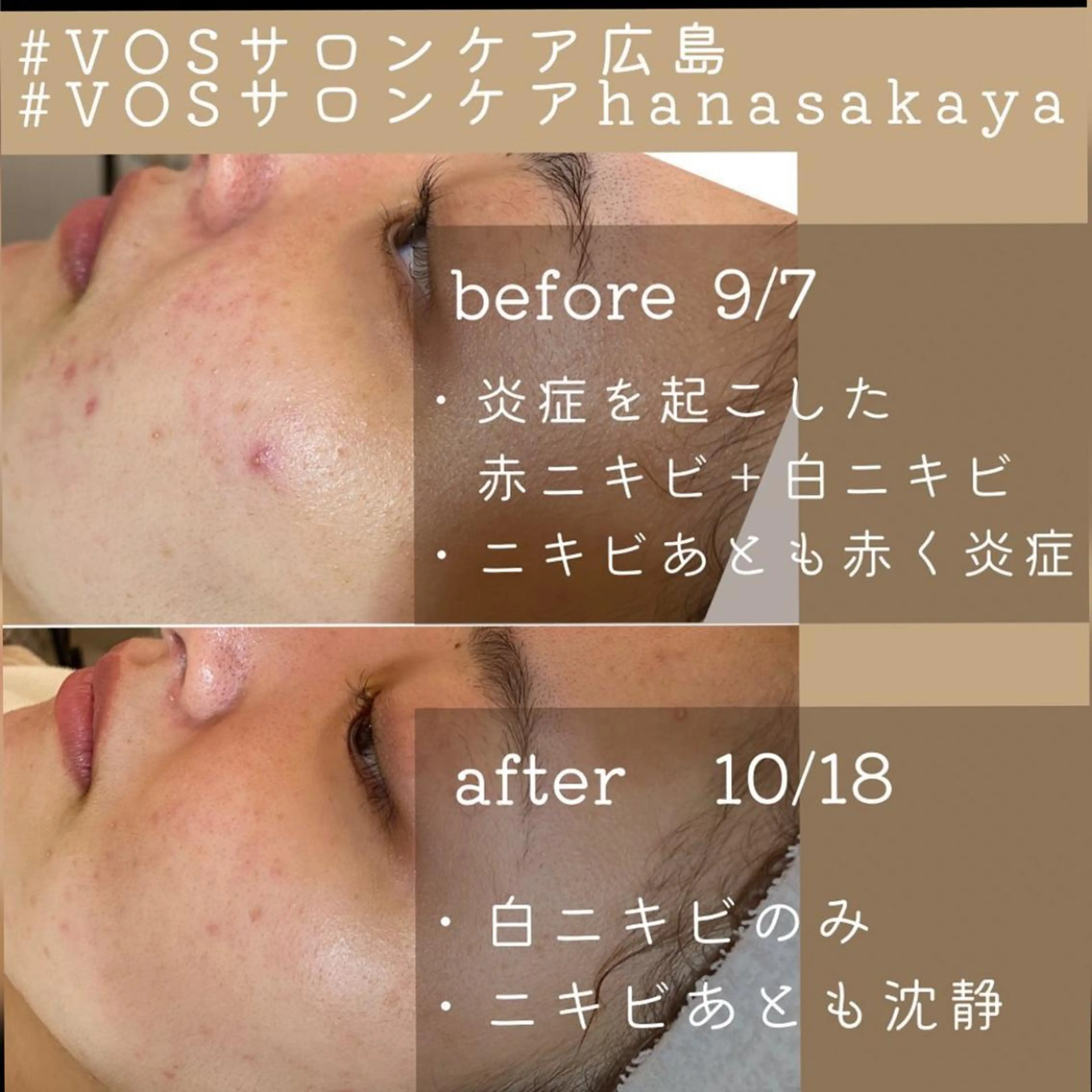 おくむら あやこのヘアスタイル