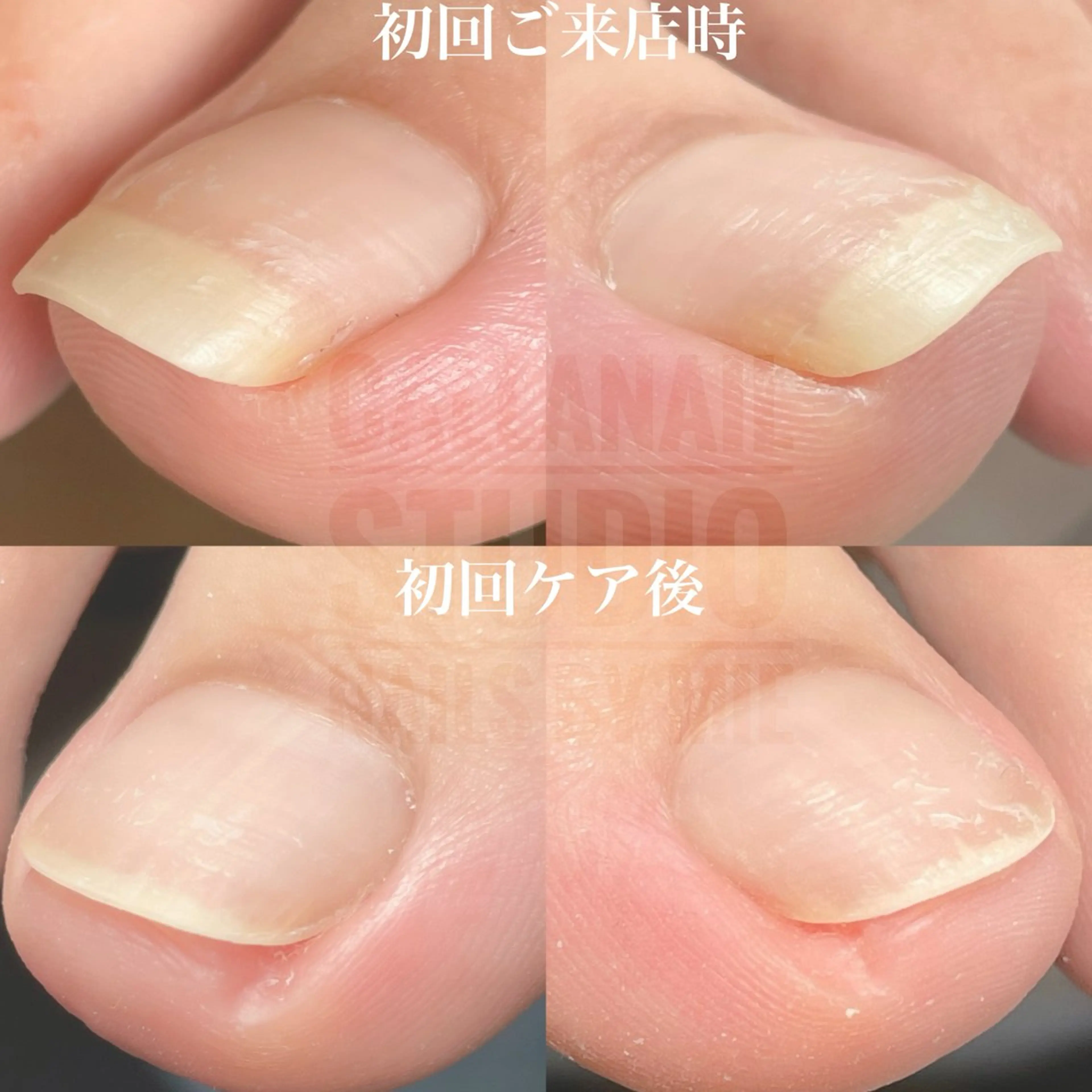 ネイル その他(ネイル) mie ミイのネイルデザイン