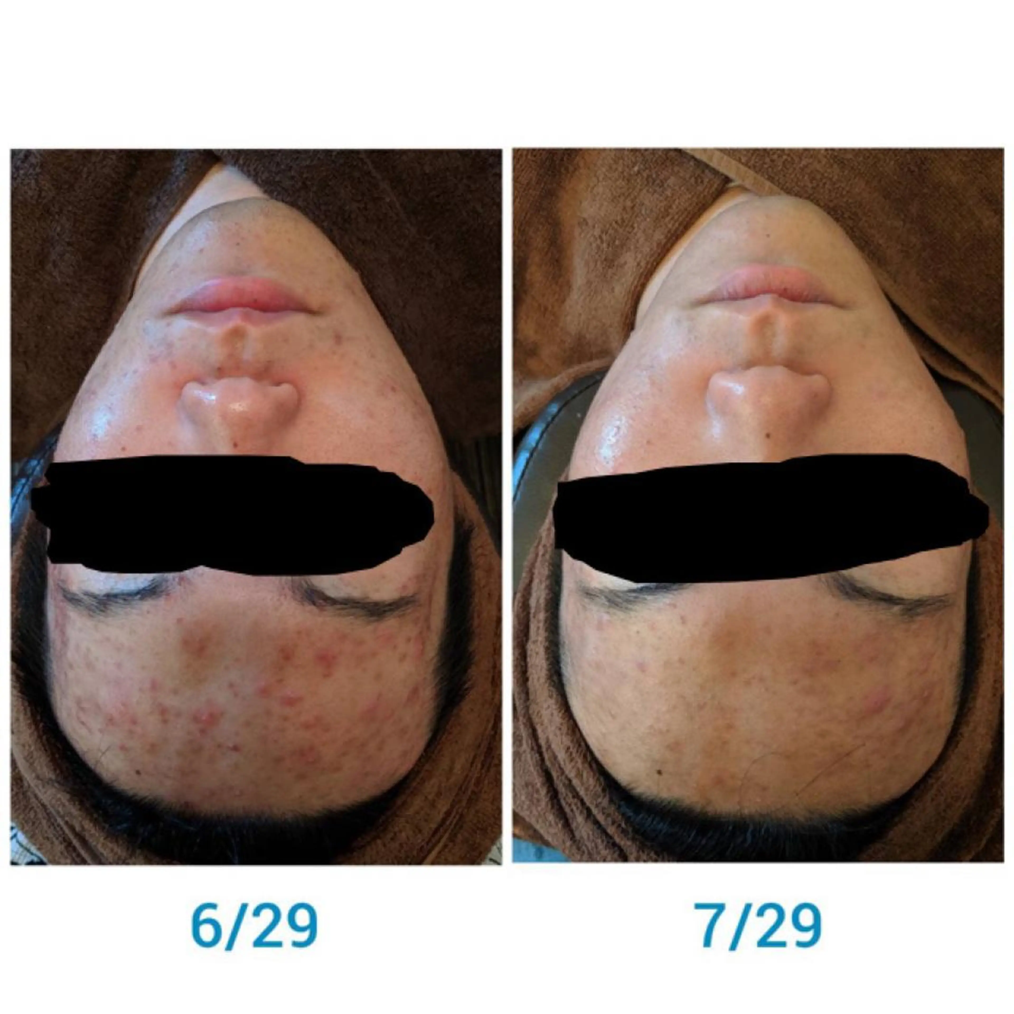 セミロング カラー パーマ ヘアアレンジ メンズ キッズ ネイル マツエク・マツパ エステ リラク 肌質体質を変えて すっぴん肌にのエステ・リラクイメージ