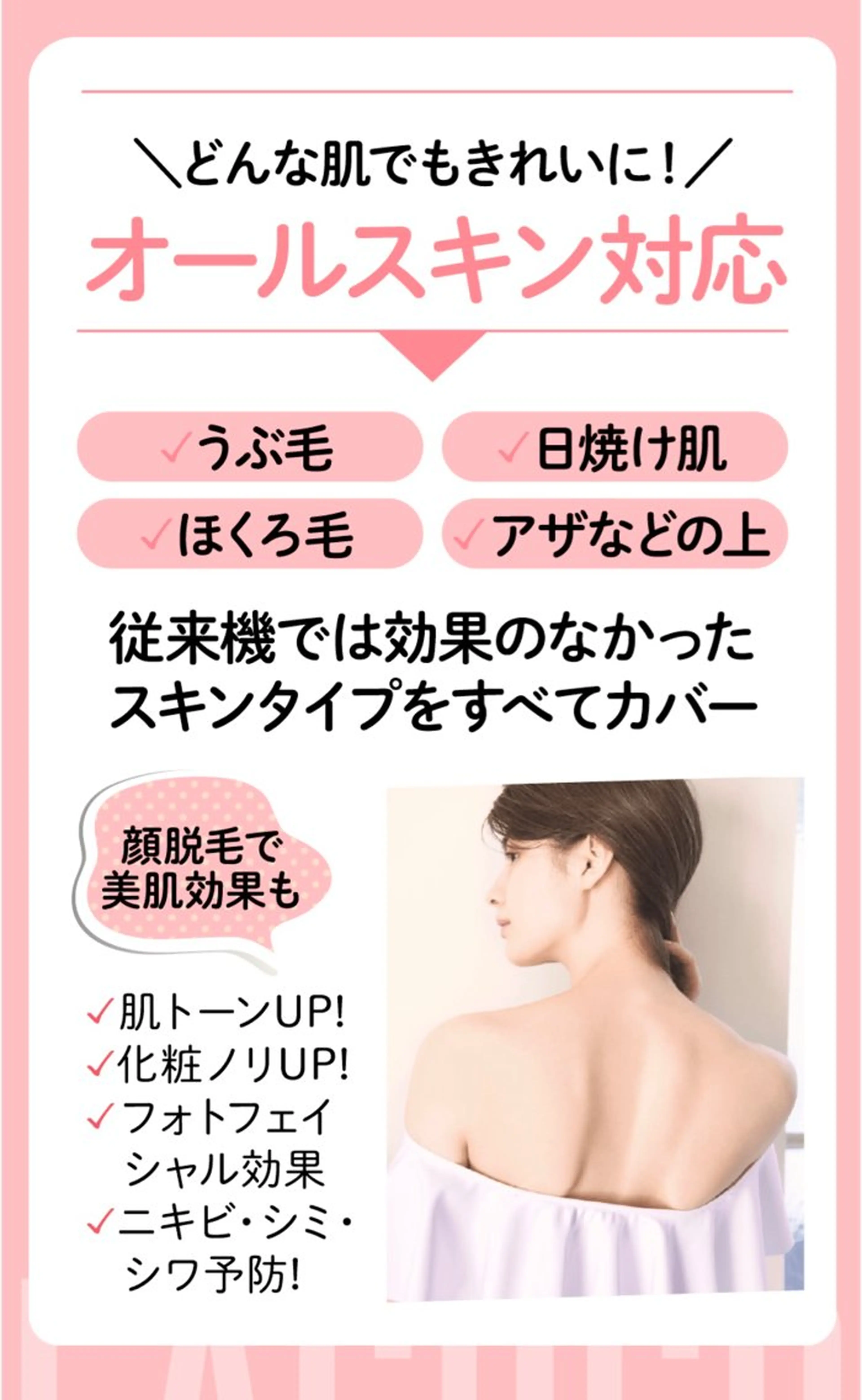 【ルミクス脱毛】　Sパーツ（部分的な部分・両ワキ・手の甲&指・足の甲&指・胸など）の写真