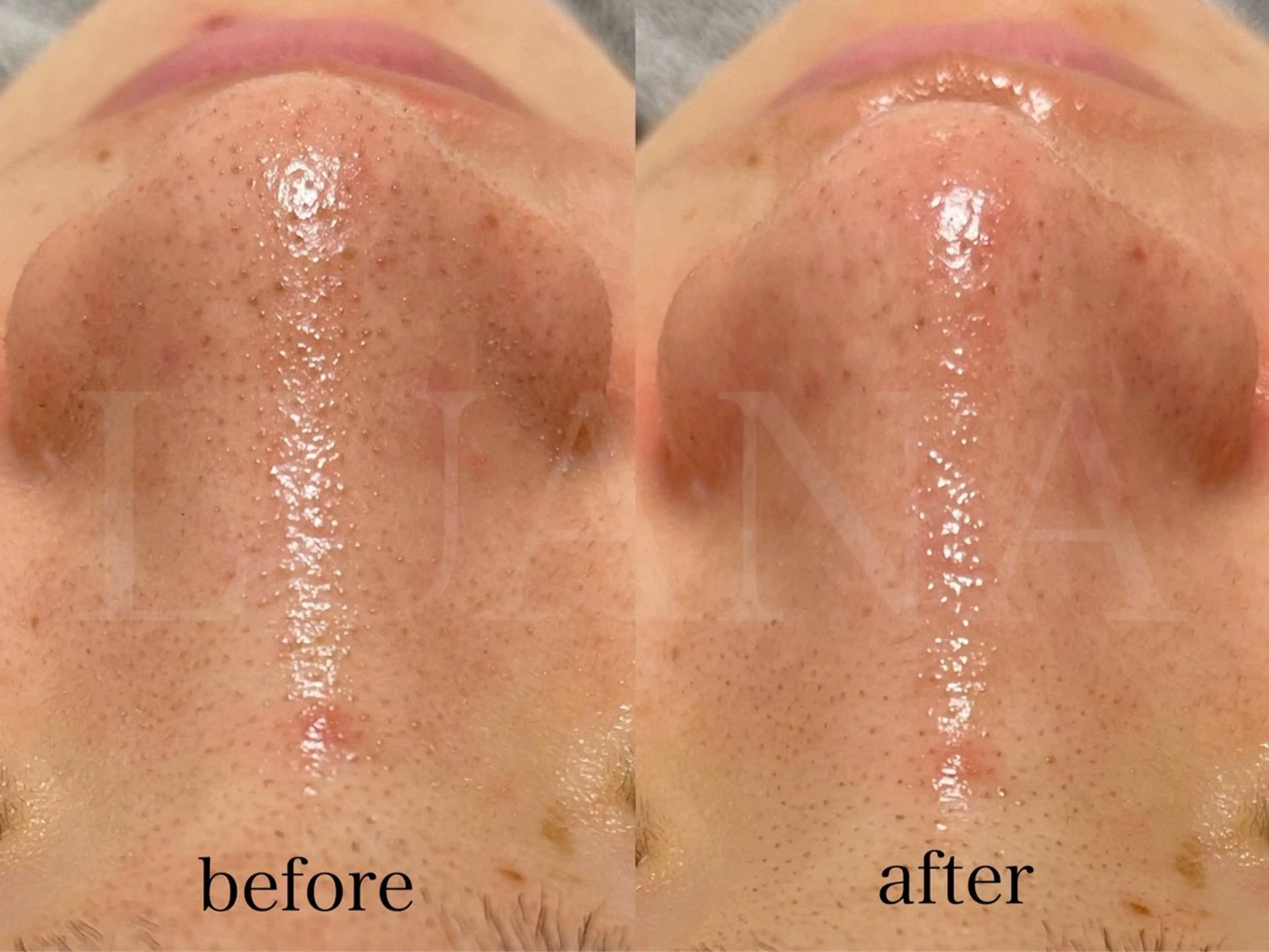 メンズ エステ LUANA TAKAGIの眉毛・アイブロウイメージ