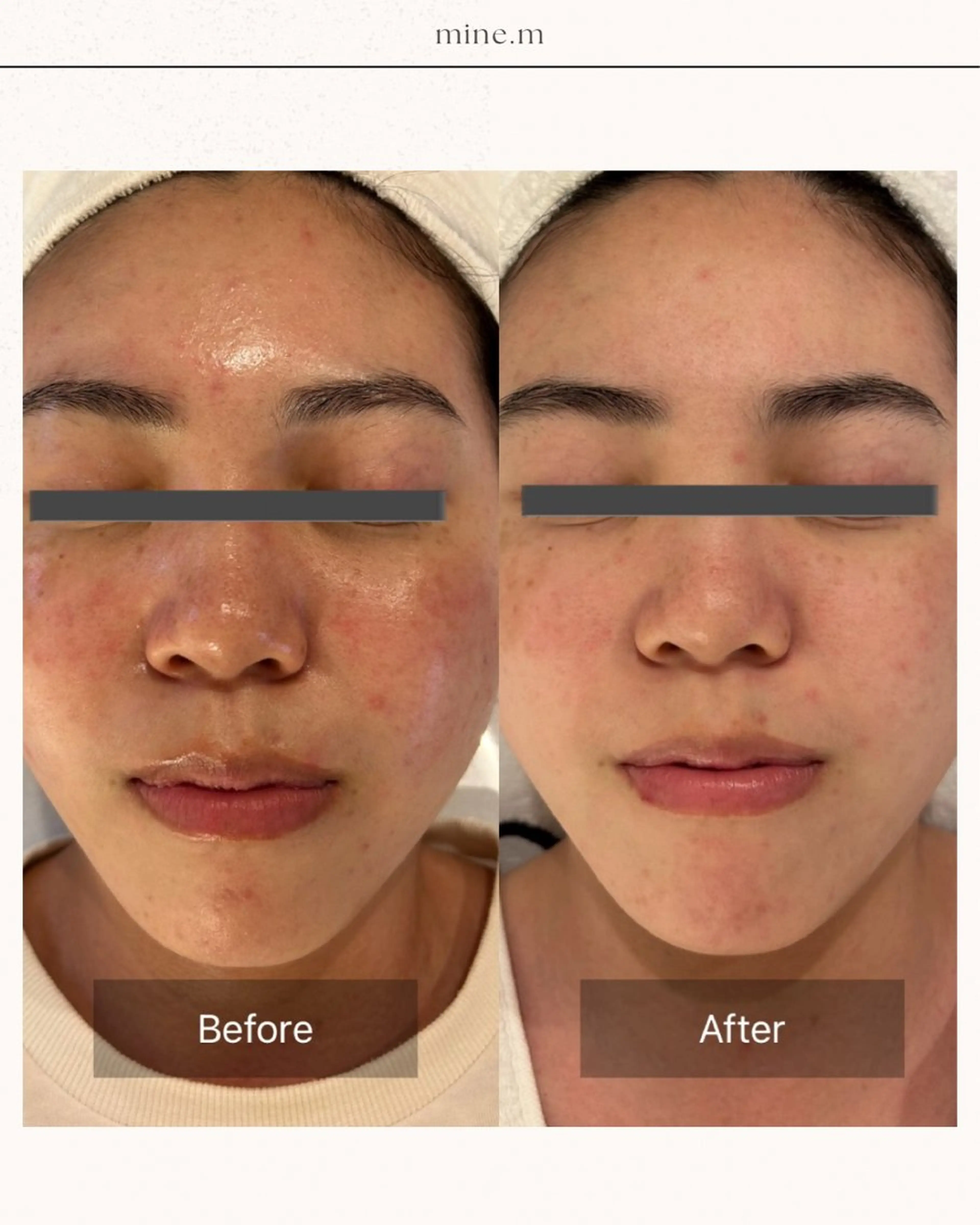 mine.mマインエム所属・mine.mi マインエムのエステ・リラクイメージ