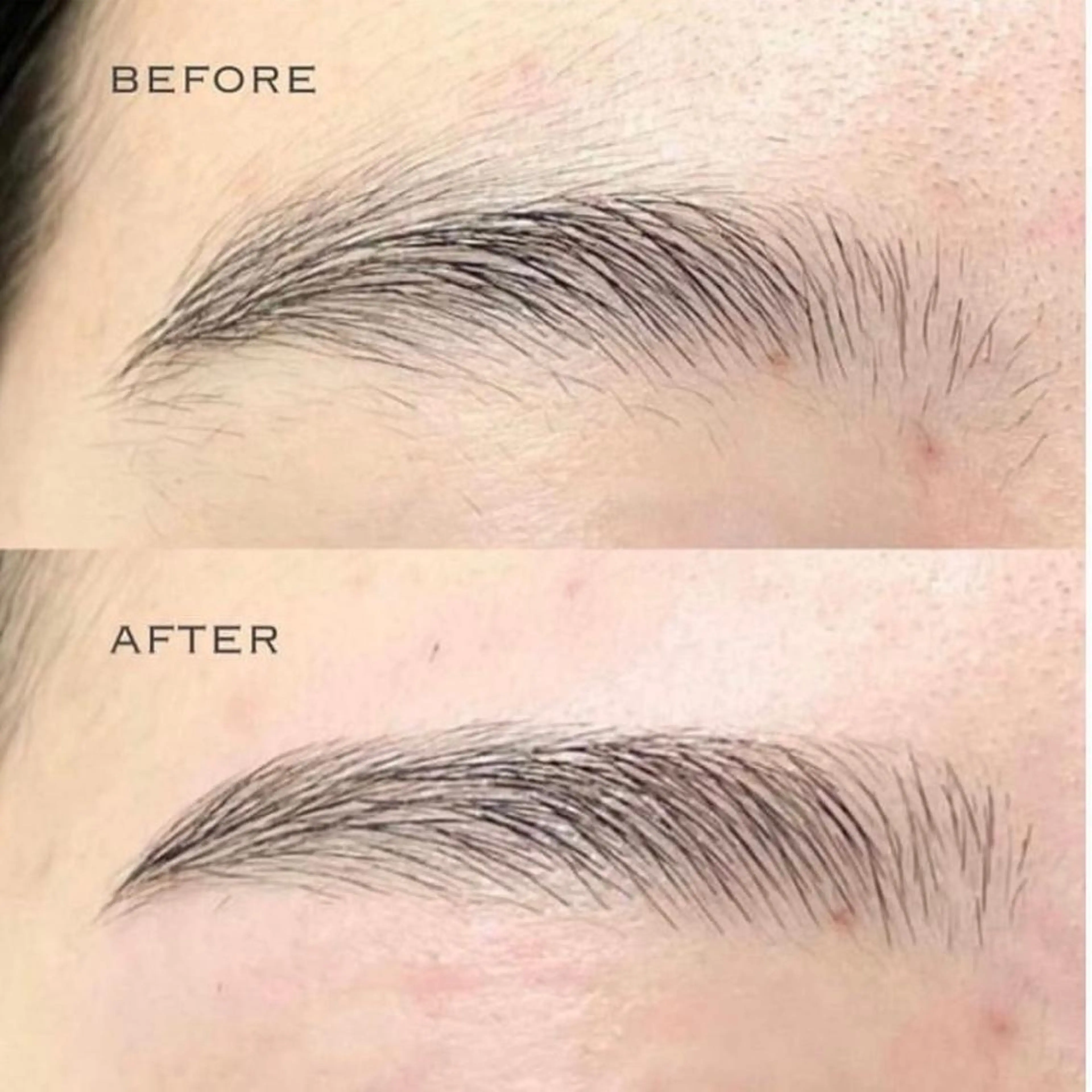 アイブロウ BONITO所属・TOYOOKA ERUMOのエステ・リラクイメージ