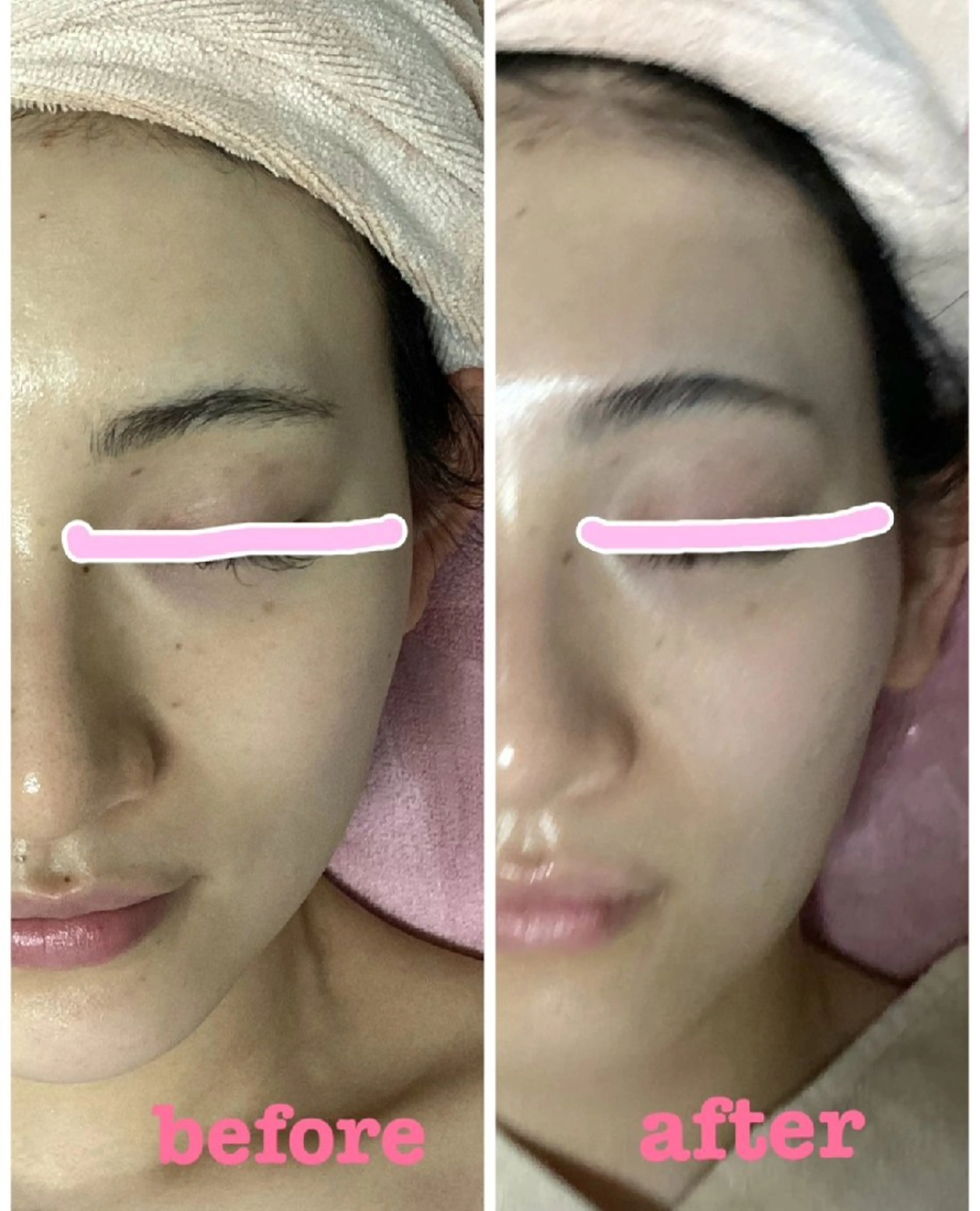 小顔エステsakura🌸belle(サクラベル)所属・小顔エステ サクラ🌸ベルのエステ・リラクイメージ