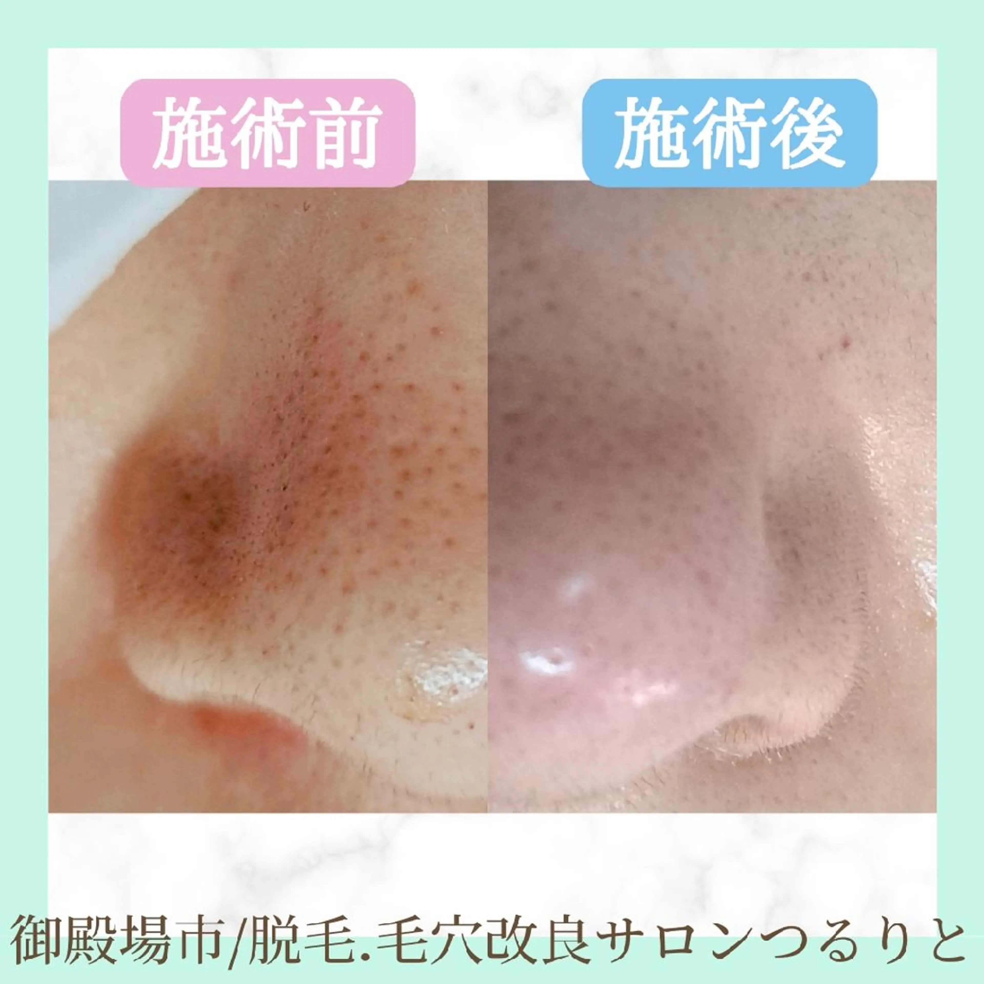 美肌脱毛サロン つるりと御殿場店所属・美肌脱毛サロン つるりとのその他イメージ