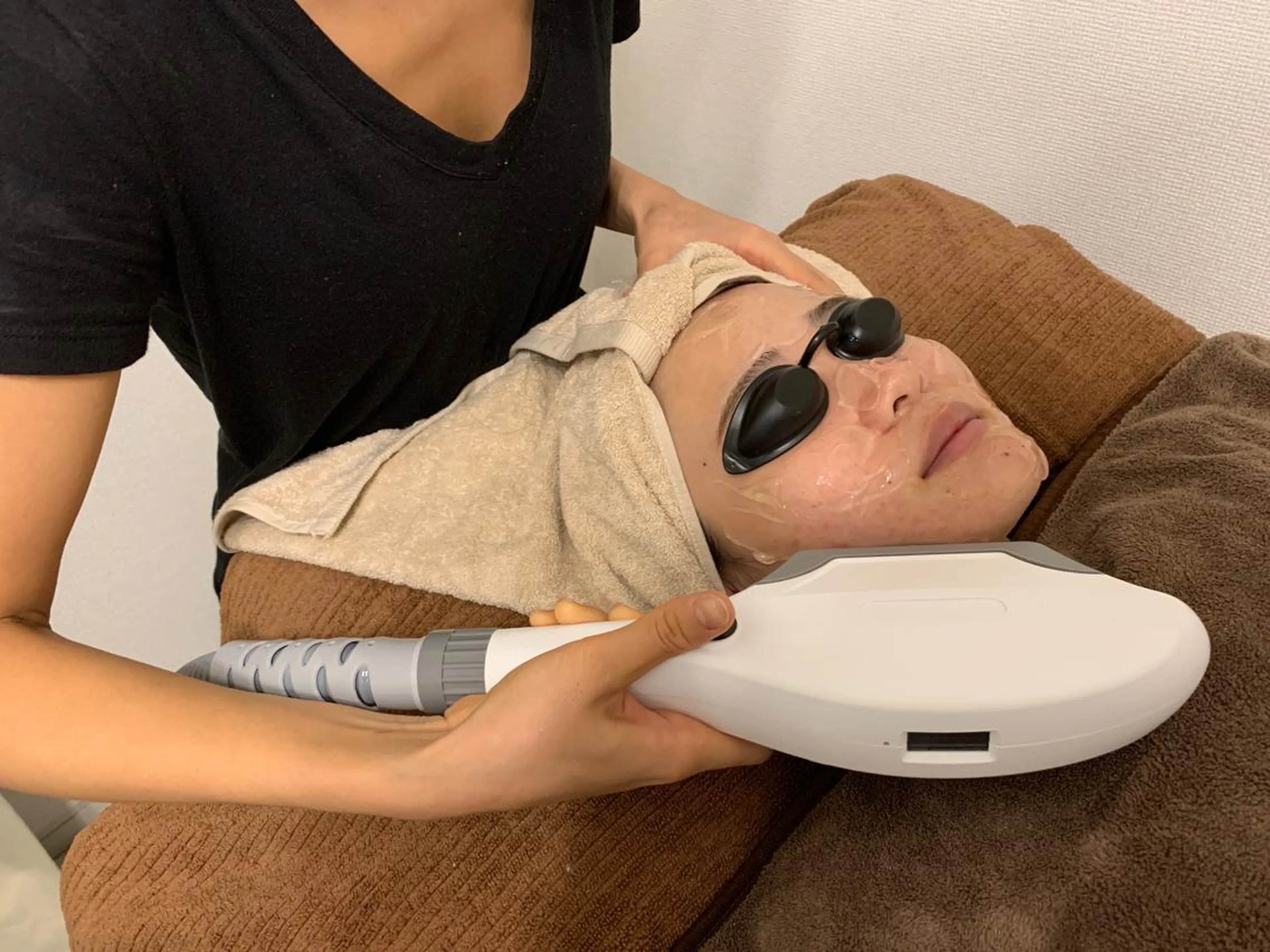 【脱毛/全顔】ハイブリッド光脱毛&毛穴洗浄付き✨の写真