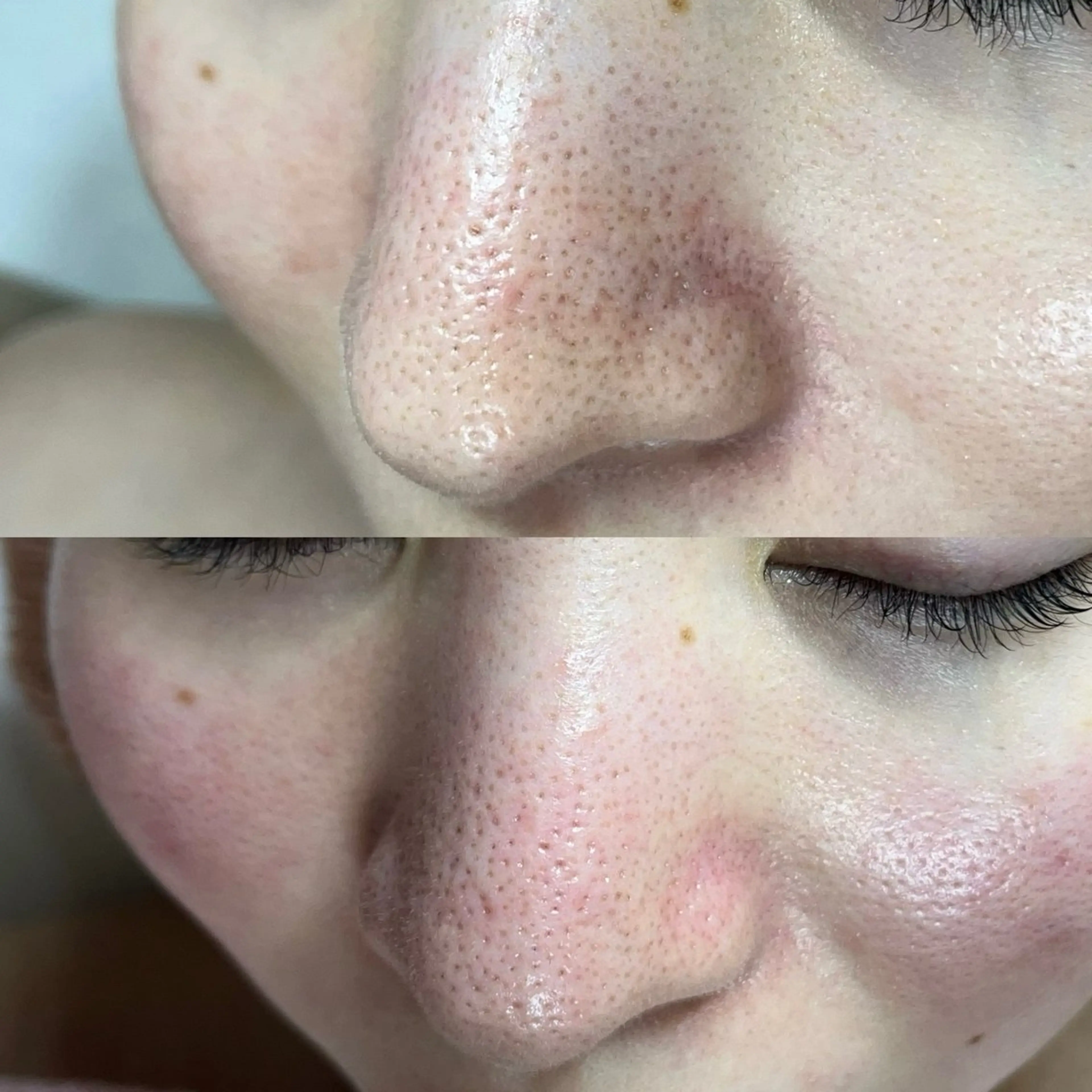 毛穴ケア・ヘッドスパサロンSHINY(シャイニー)所属・毛穴ケア・ヘッドスパ サロンSHINYのエステ・リラクイメージ