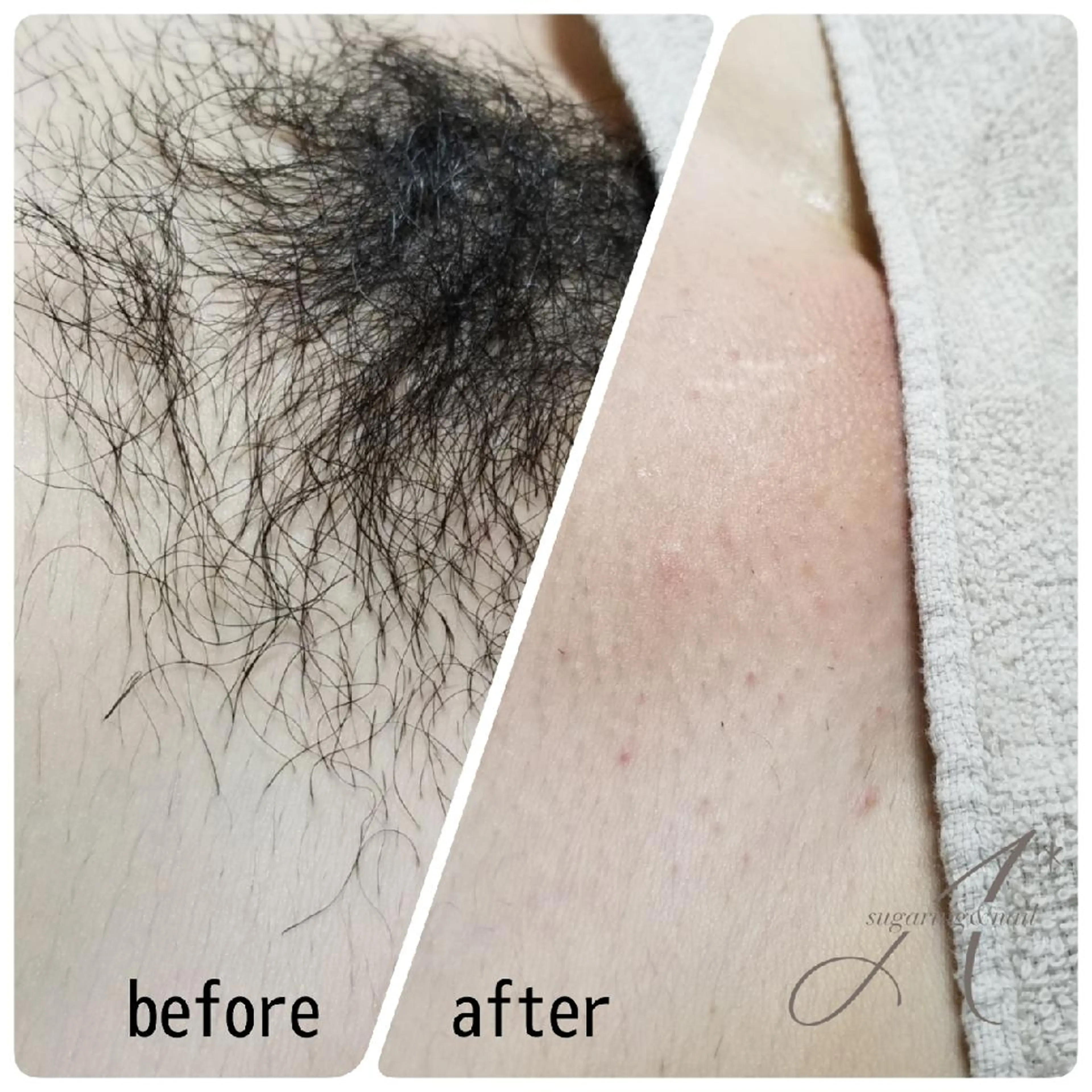 マツエク・マツパ ネイル キッズ ヘアアレンジ パーマ カラー ショート A*[エースター] シュガーリング🍋のエステ・リラクイメージ