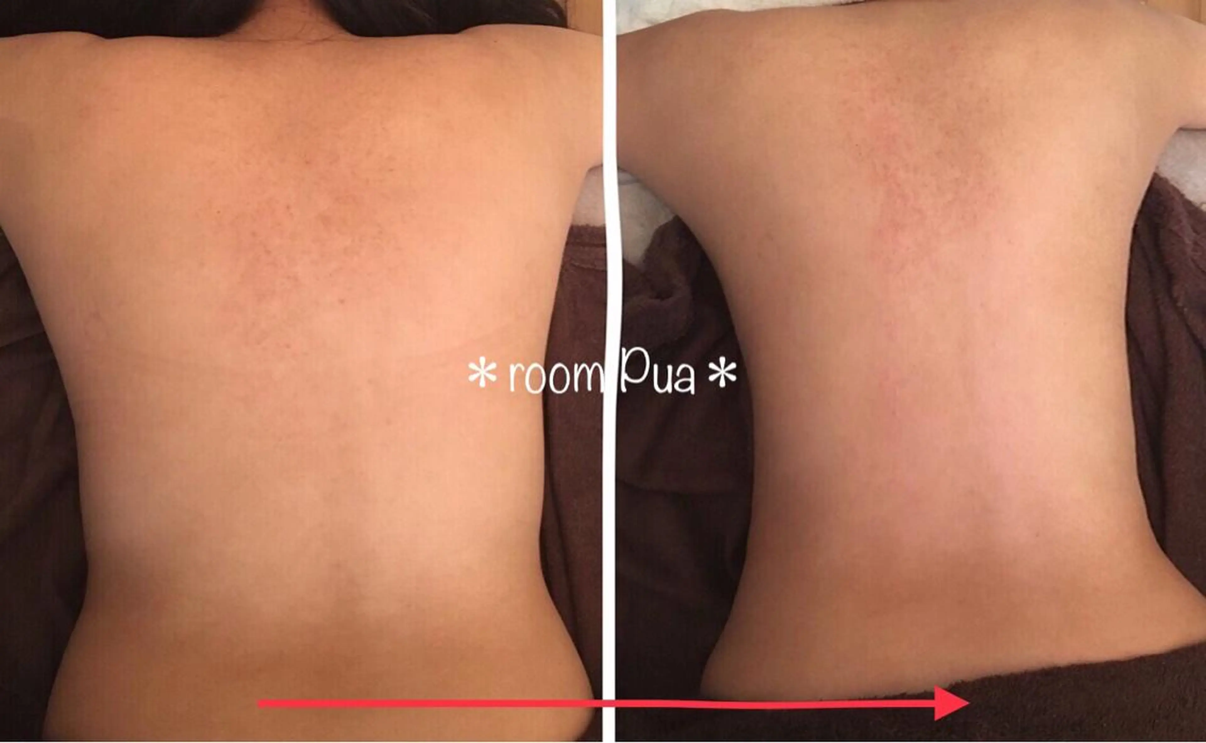 【下半身or上半身】オールハンド痩身エステ/部位集中/ボディメイキングの写真