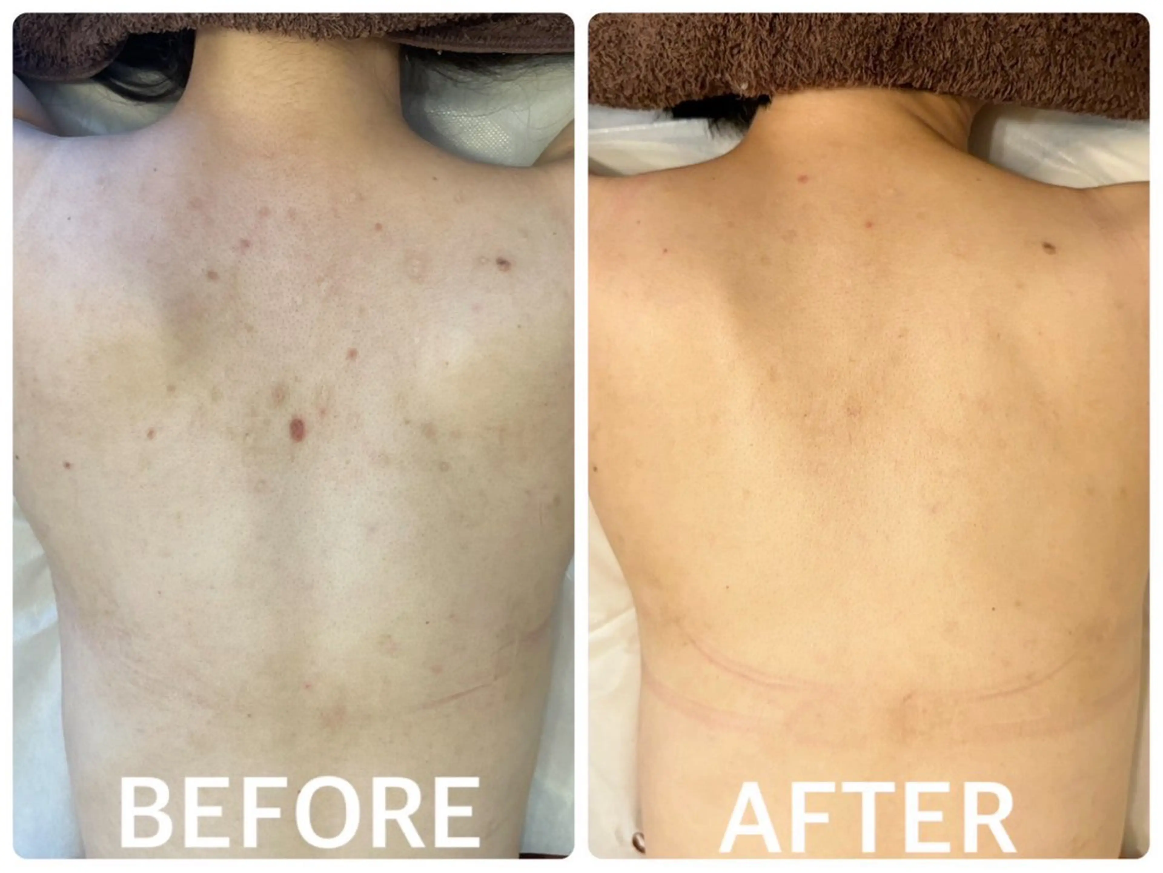 ハーブピーリング 横浜のエステ・リラクイメージ