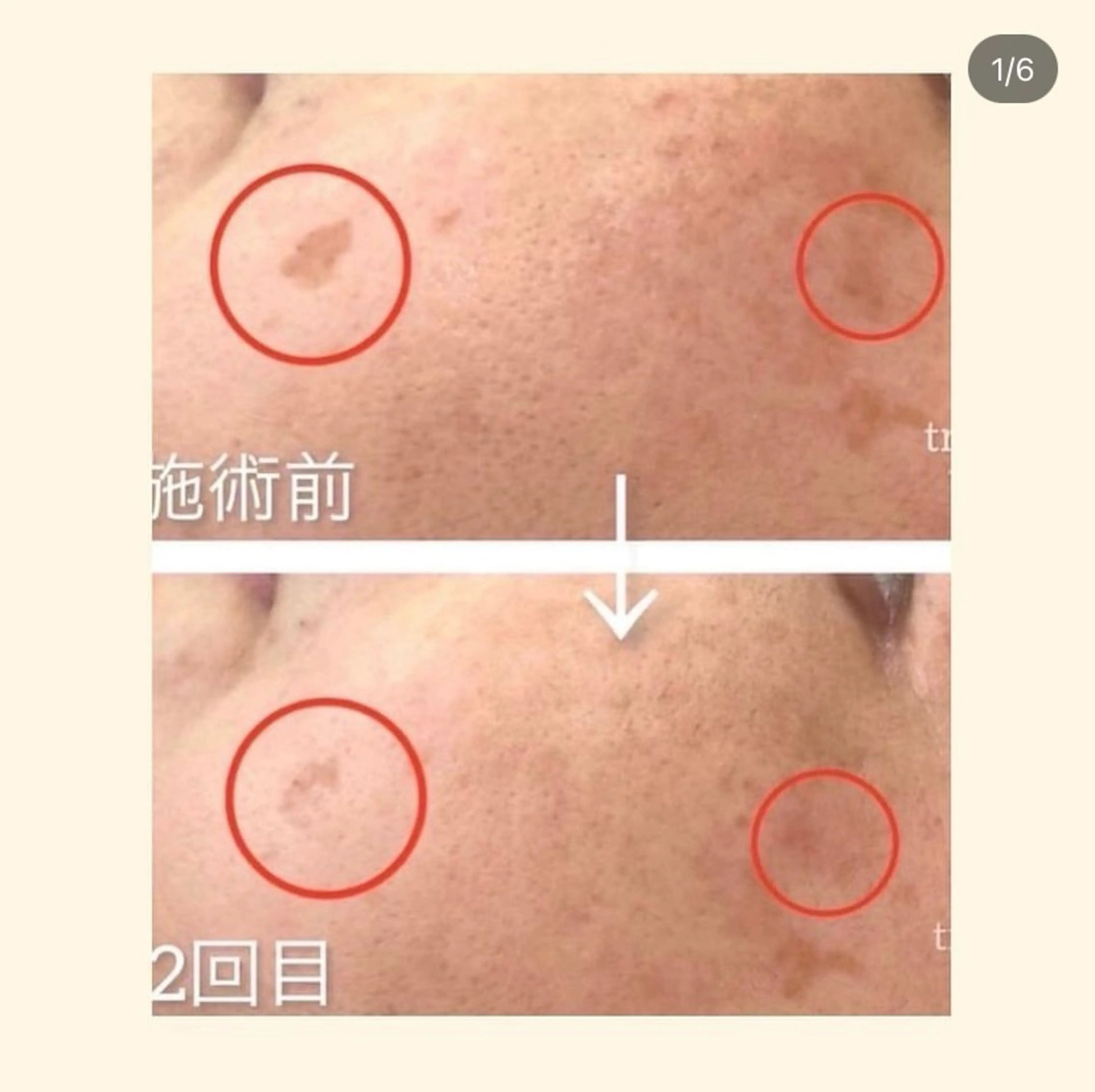 その他 韓国肌管理 【毛穴専科】のエステ・リラクイメージ