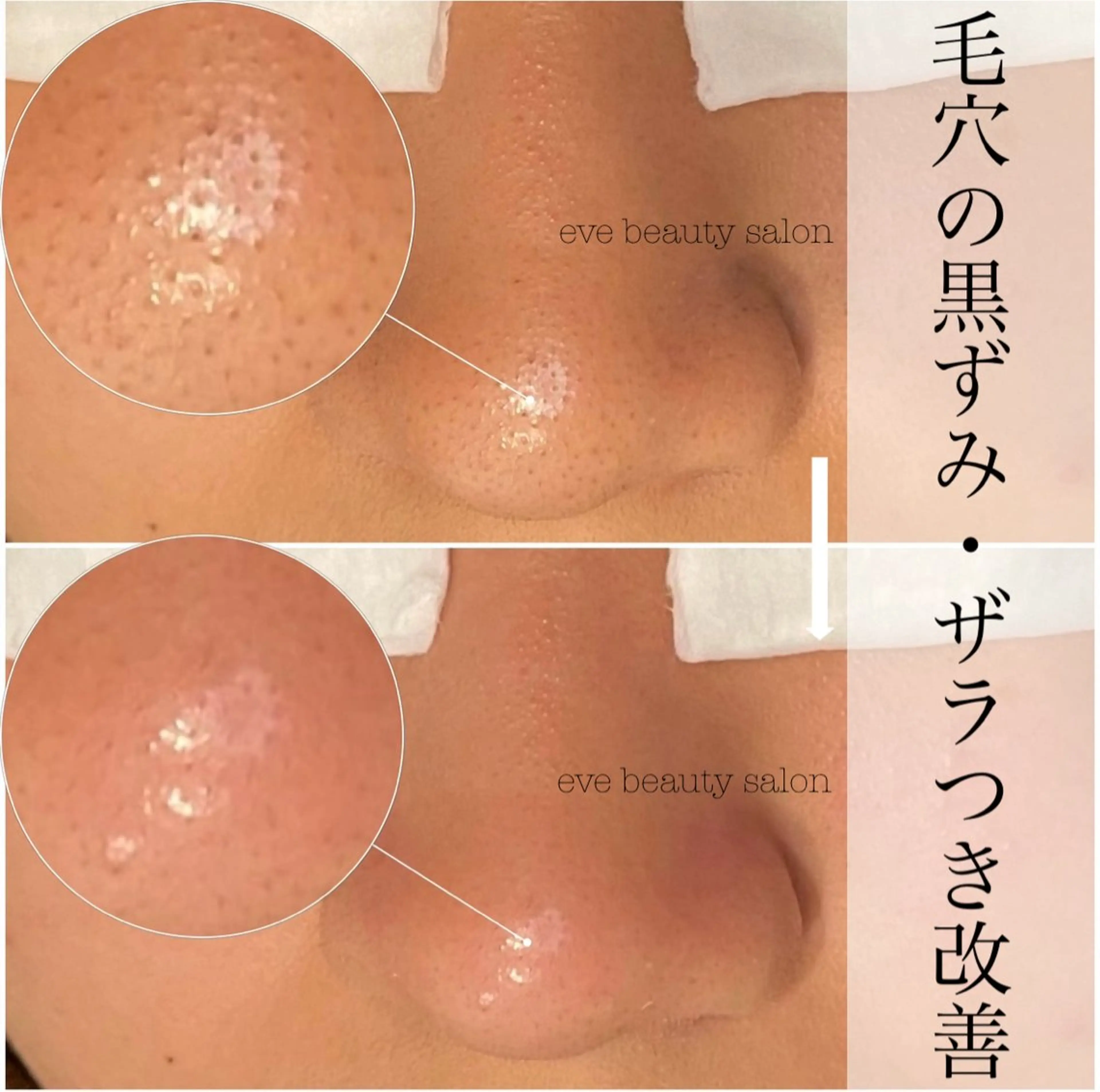 eve beauty salon所属・毛穴改善サロン CALLAのエステ・リラクイメージ