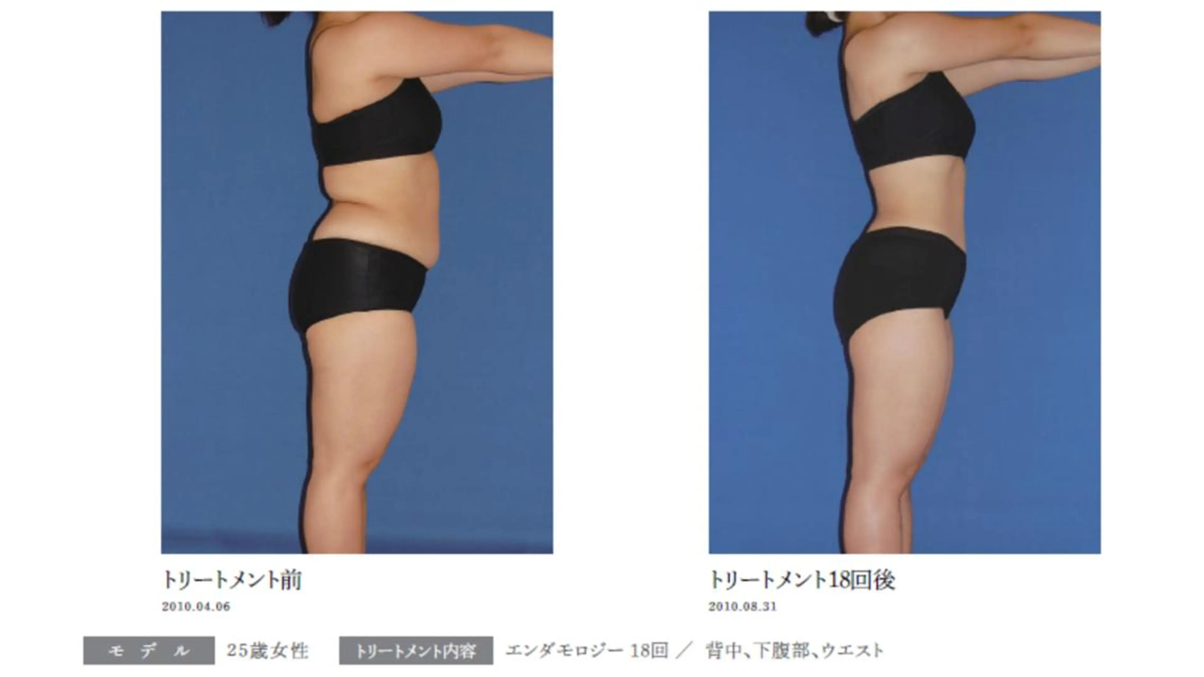 オレンジバナナ 新潟店のエステ・リラクイメージ