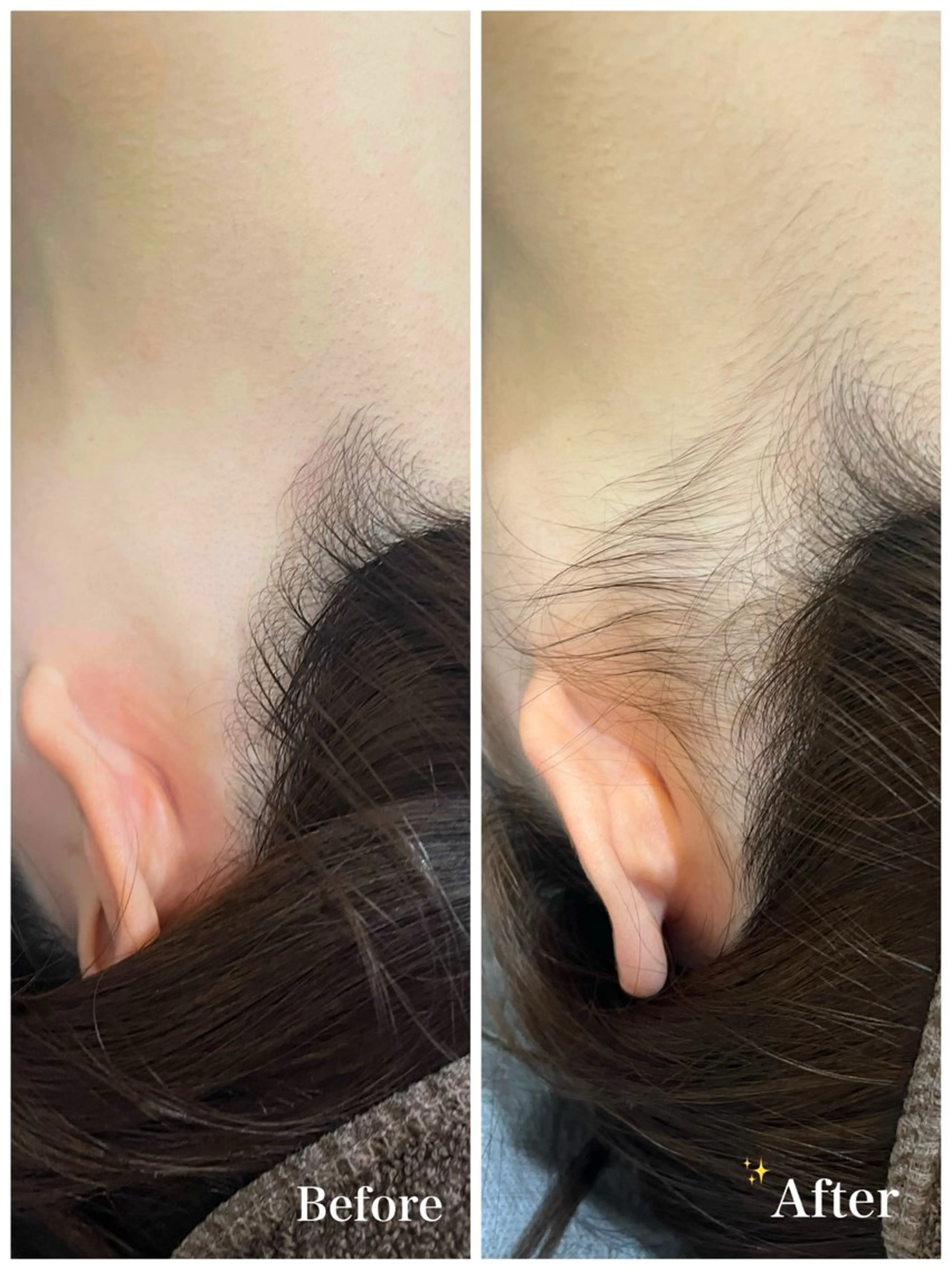 脱毛 脱毛サロン fam.豊澤柚良のエステ・リラクイメージ