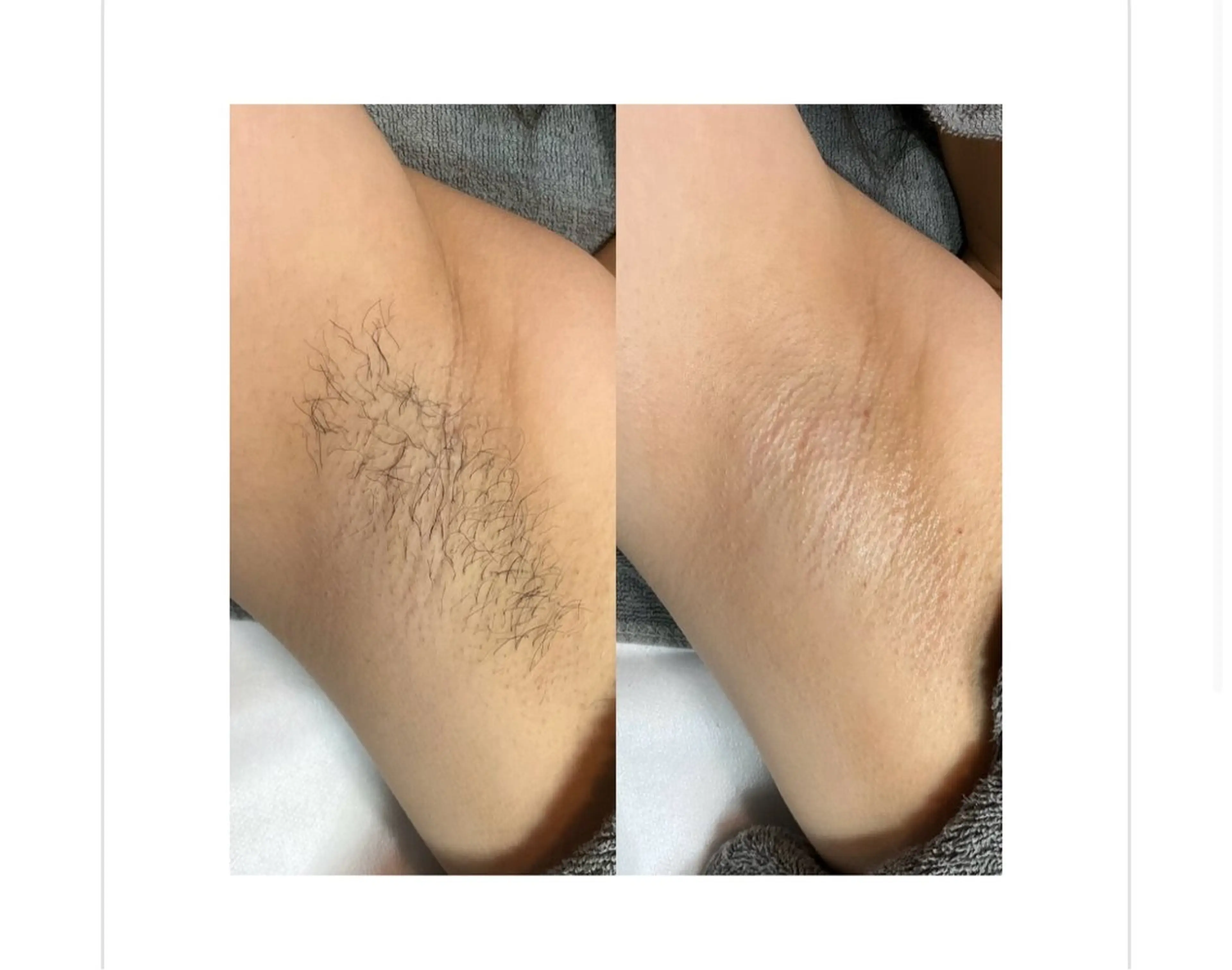 Bloom 池袋西口店〔ブルーム〕所属・池袋SATOMI🫧 完全度払い脱毛のエステ・リラクイメージ