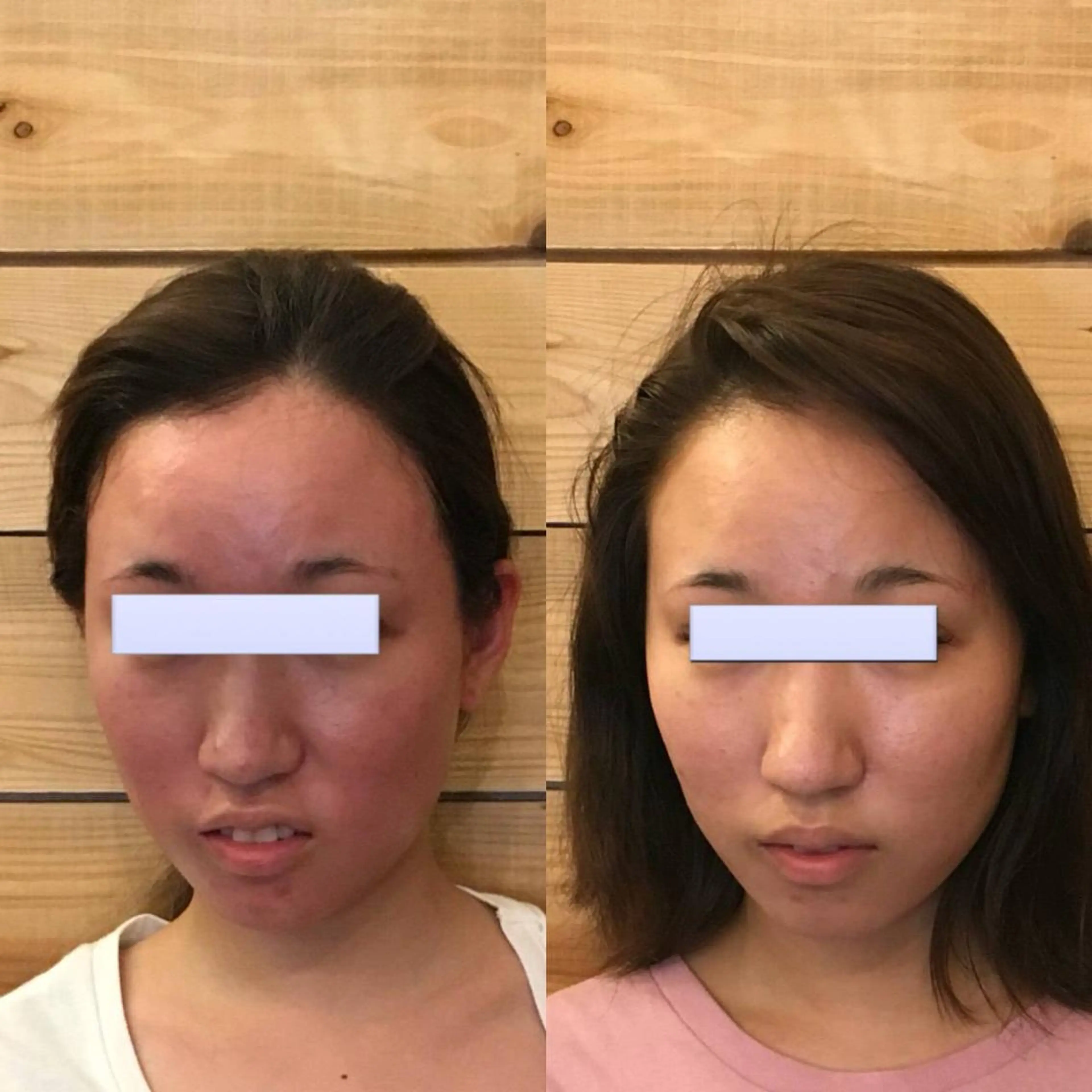 エステ リラク HARIS(ハリス) 院長Shimのエステ・リラクイメージ