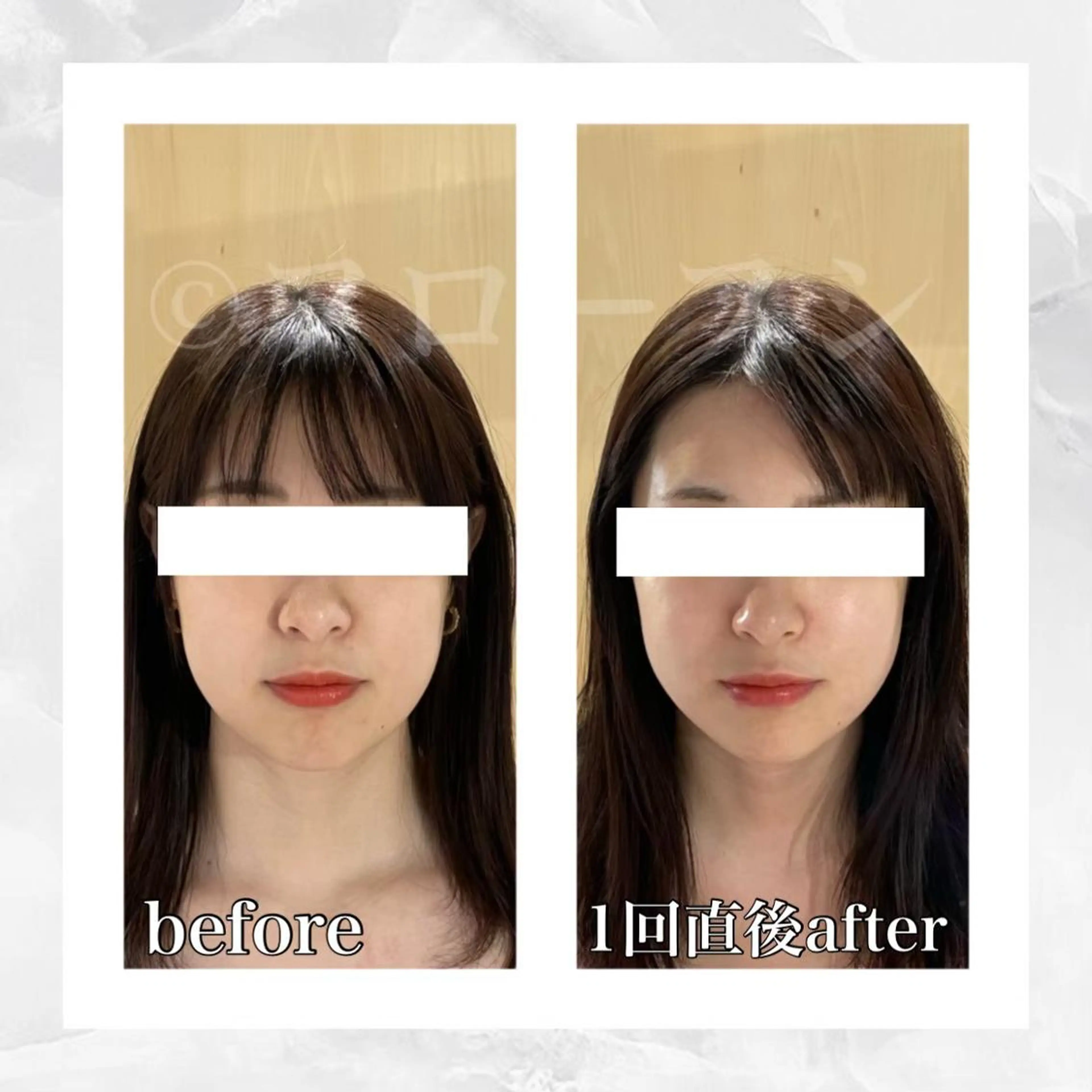 エステ リラク 部分痩せ♥️小顔専門 MIKUのエステ・リラクイメージ