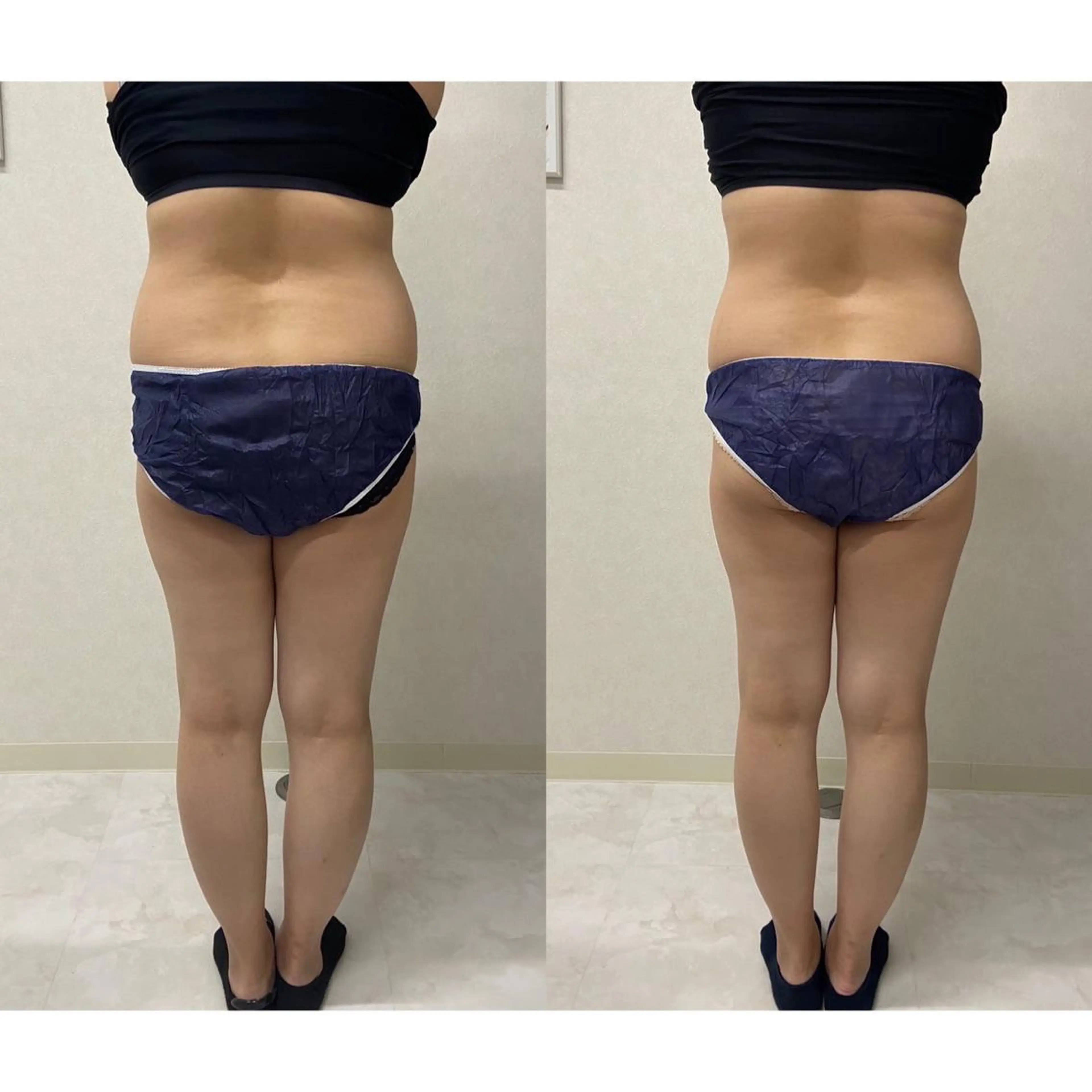 エステ リラク B againのエステ・リラクイメージ