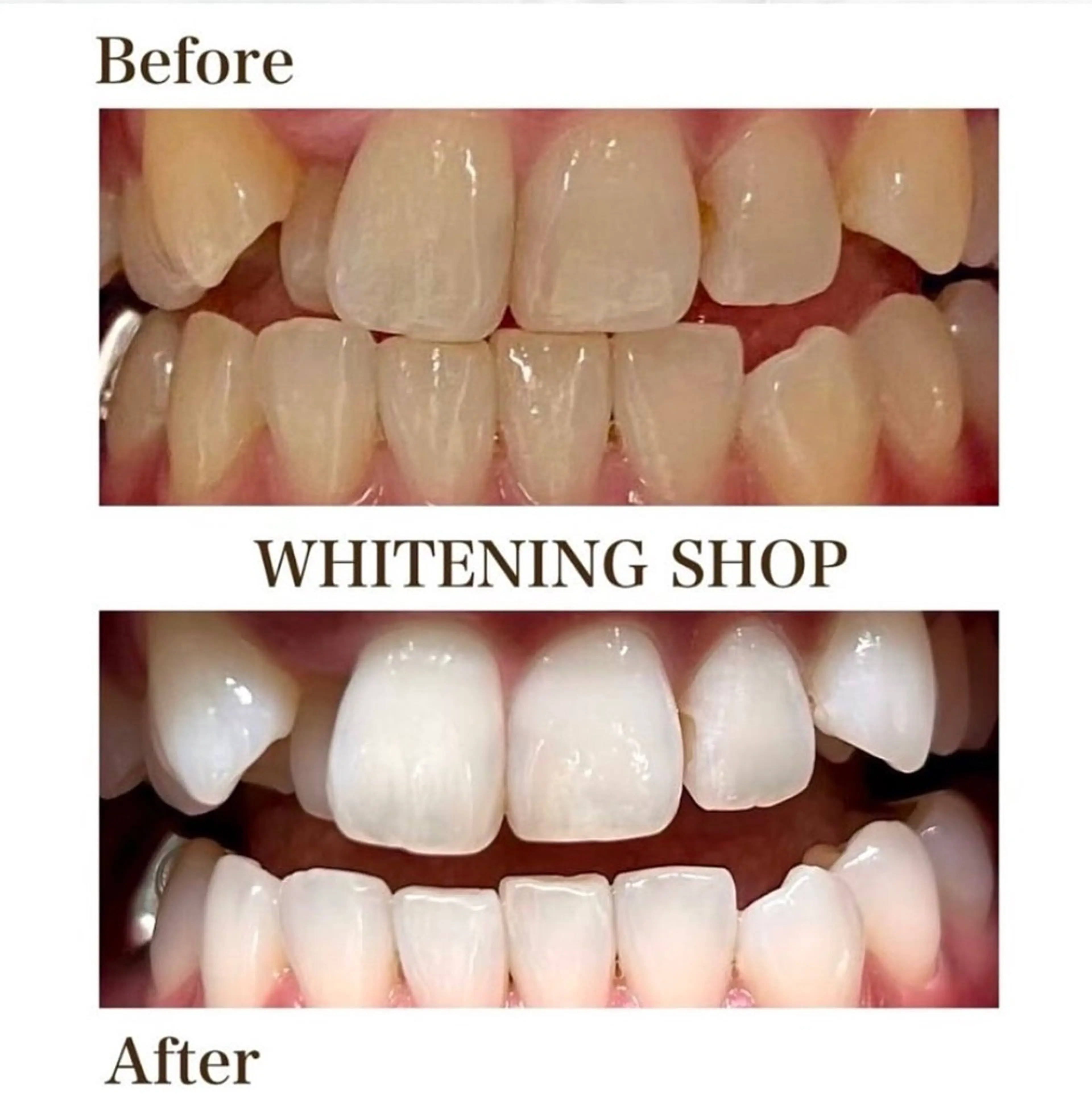 ホワイトニングショップ伊丹店所属・ホワイトニング ショップ伊丹店のその他イメージ