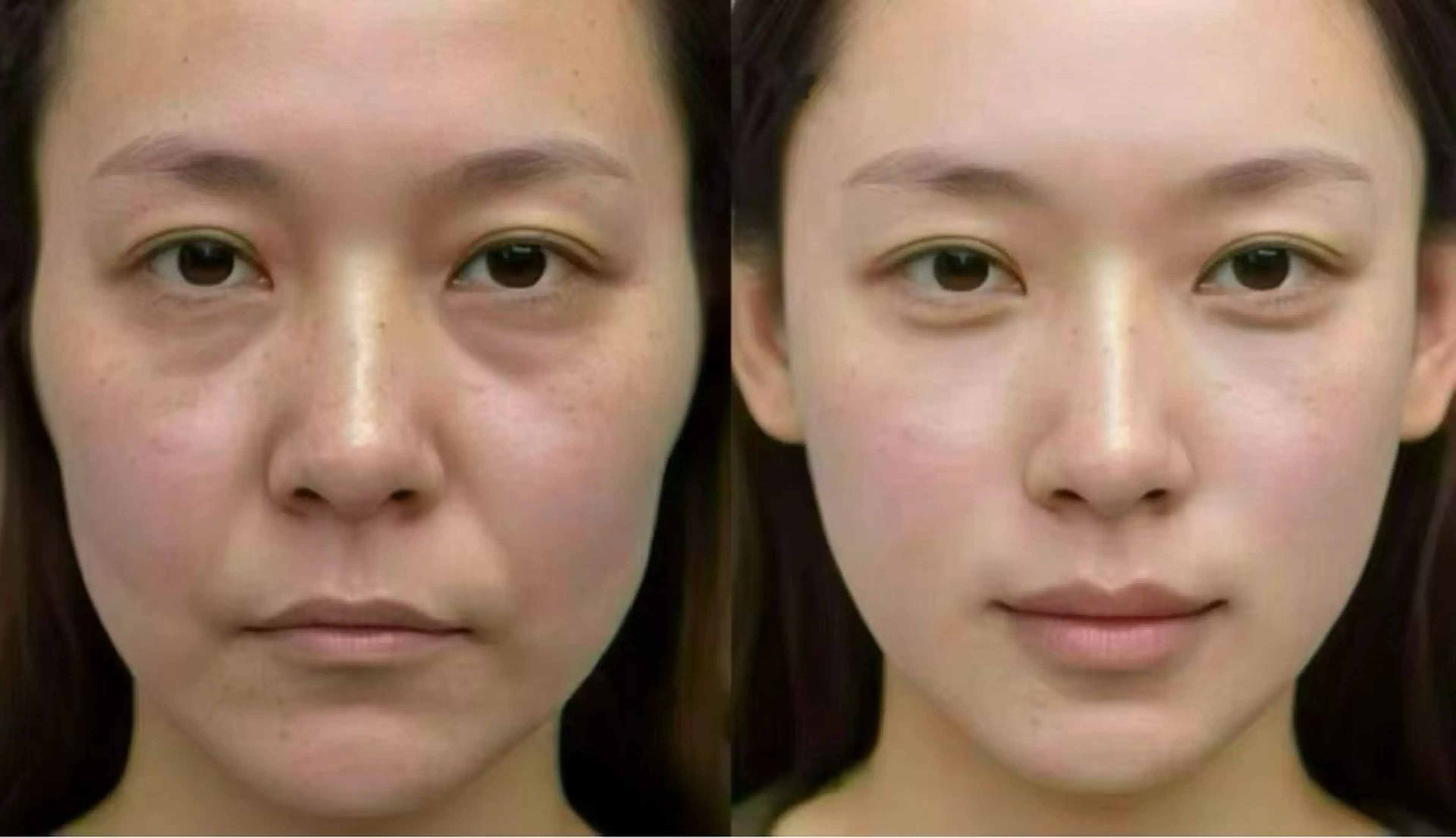 カラー エステ aliaハイフ&水光ジェットサロン所属・aliaハーブ水光店 エステティシャン募集のエステ・リラクイメージ