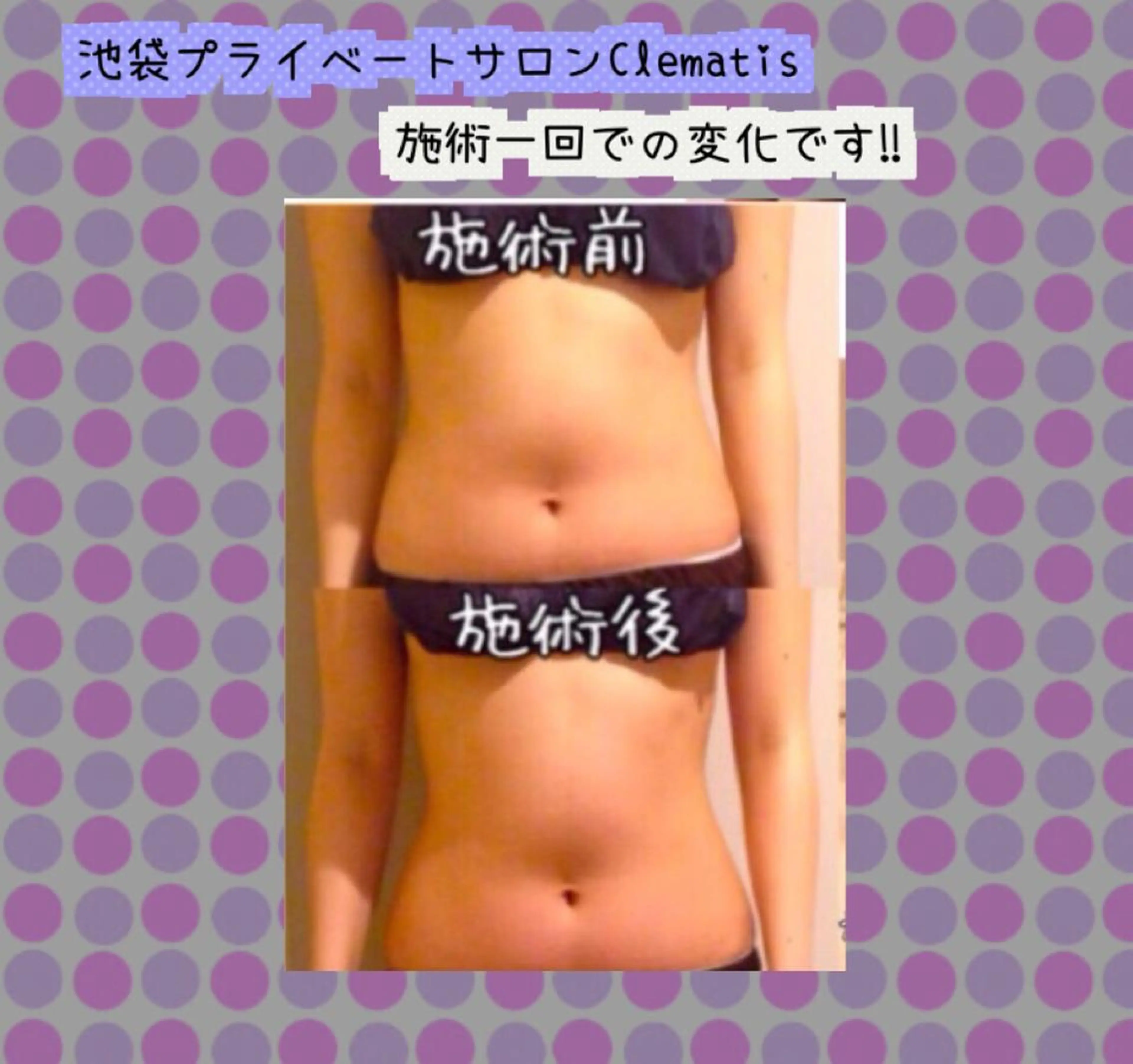 ロング カラー パーマ ヘアアレンジ メンズ キッズ ネイル マツエク・マツパ くびれヘア 強圧オールハンド痩身&黄土よもぎ蒸しプライベートサロンClematis池袋所属・強圧オールハンド痩身 片野のエステ・リラクイメージ