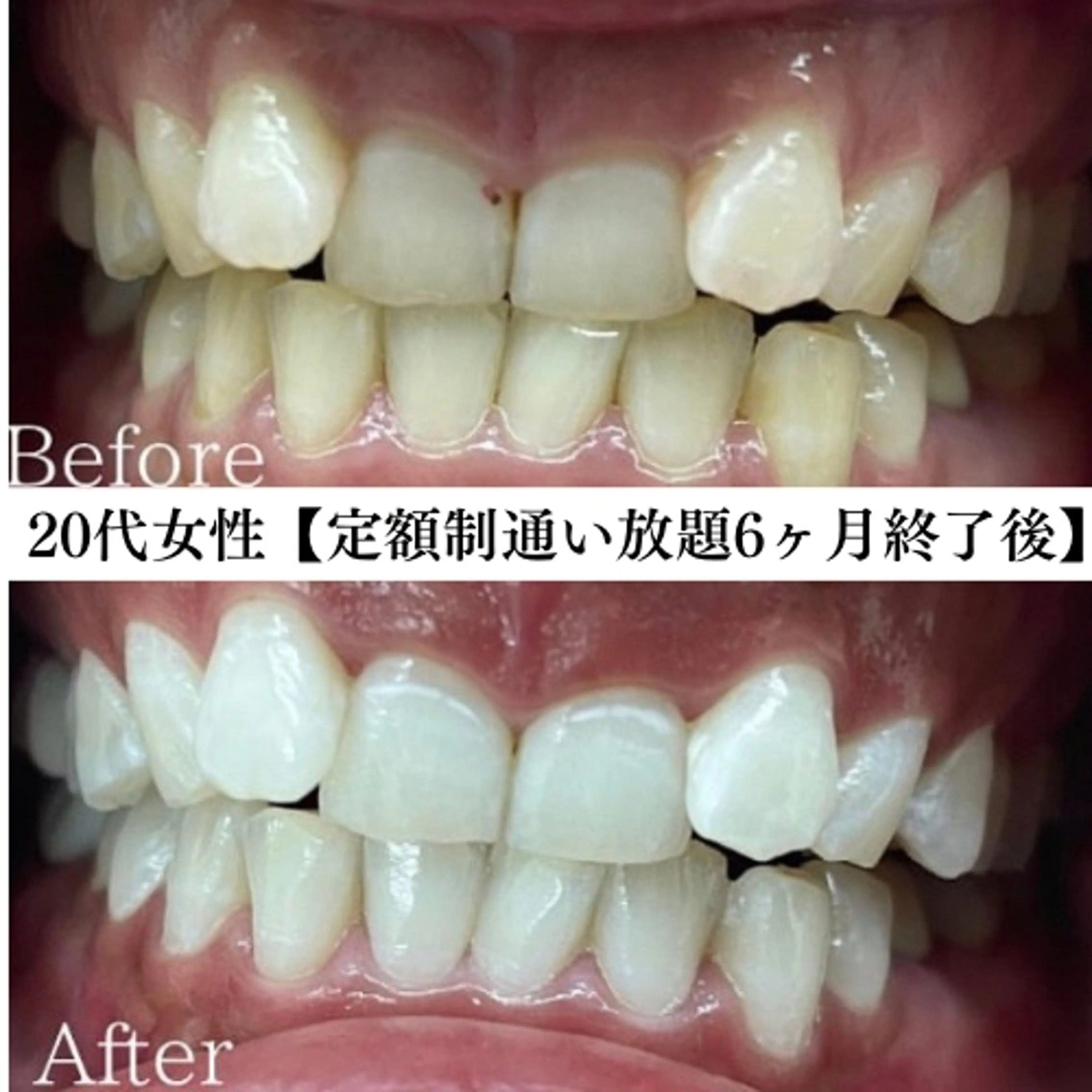 キッズ メンズ エステ リラク セルフホワイトニング専門店WHITE福岡天神店所属・セルフホワイト専門店 WHITE福岡天神店のエステ・リラクイメージ