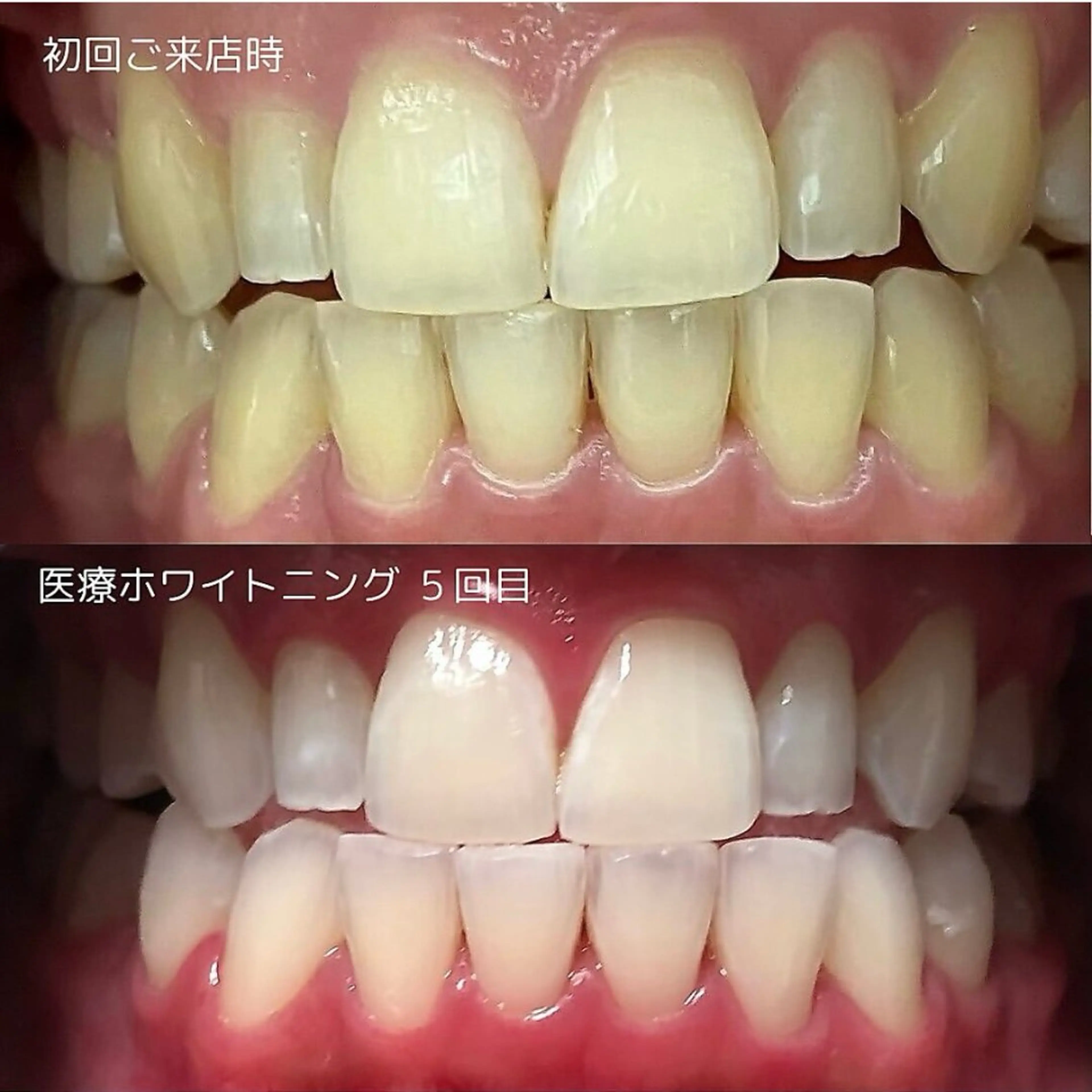 その他 salon 87 【サロン　ハナ】のその他イメージ