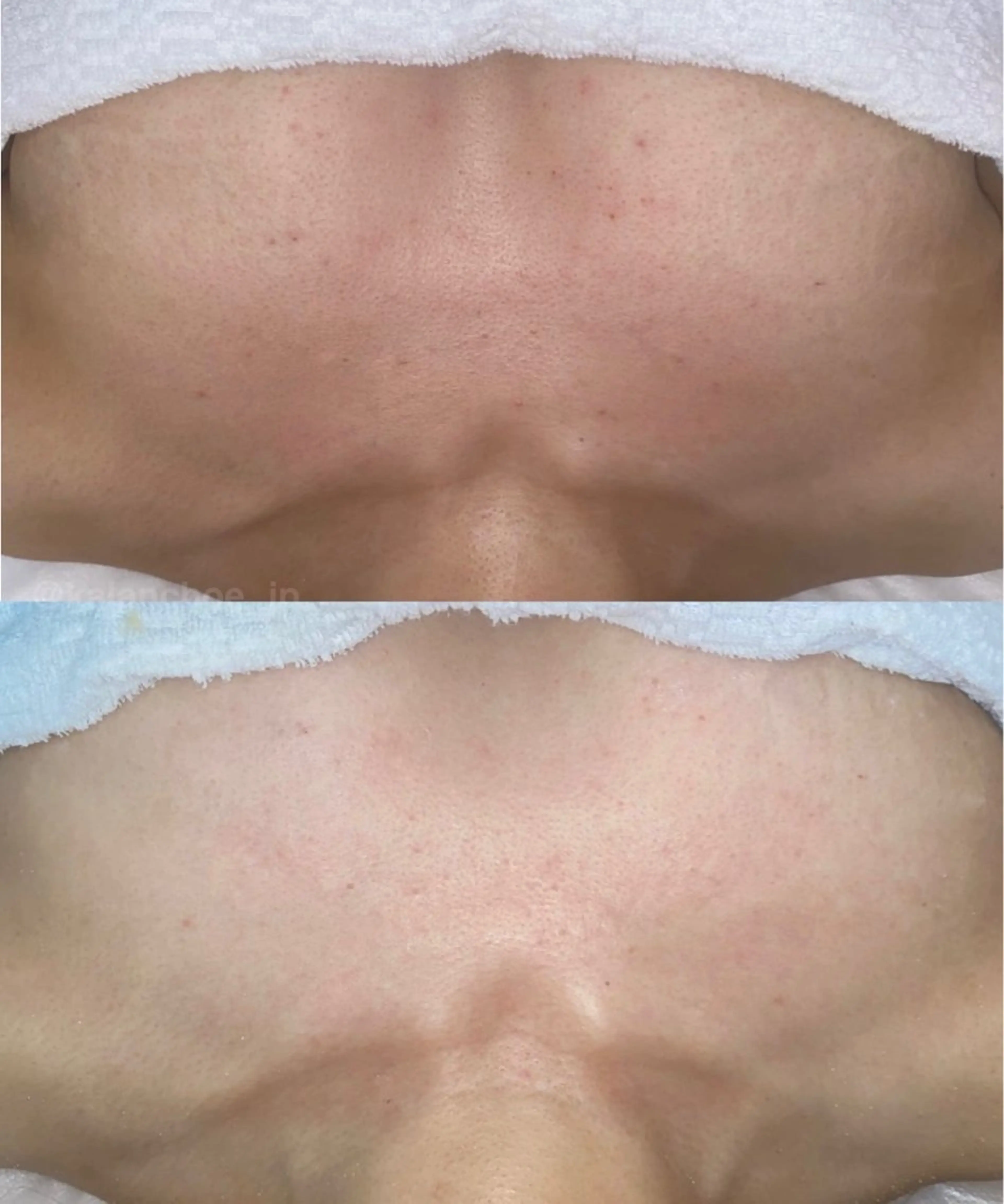 エステ 肌質改善 KALANCHOEのエステ・リラクイメージ