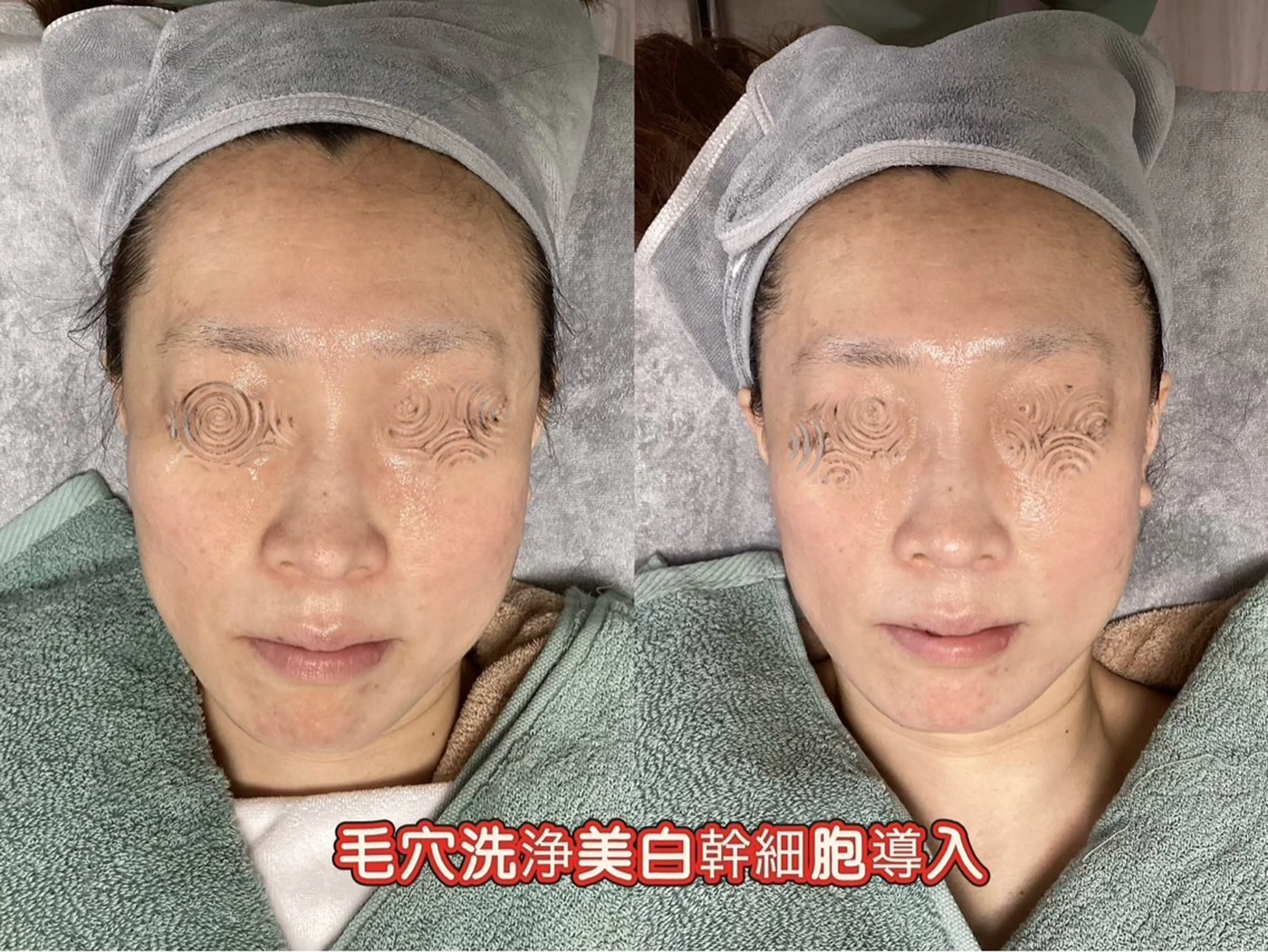 エステ リラク ホワイティアビシェル ウラワ　白澤奇のその他イメージ