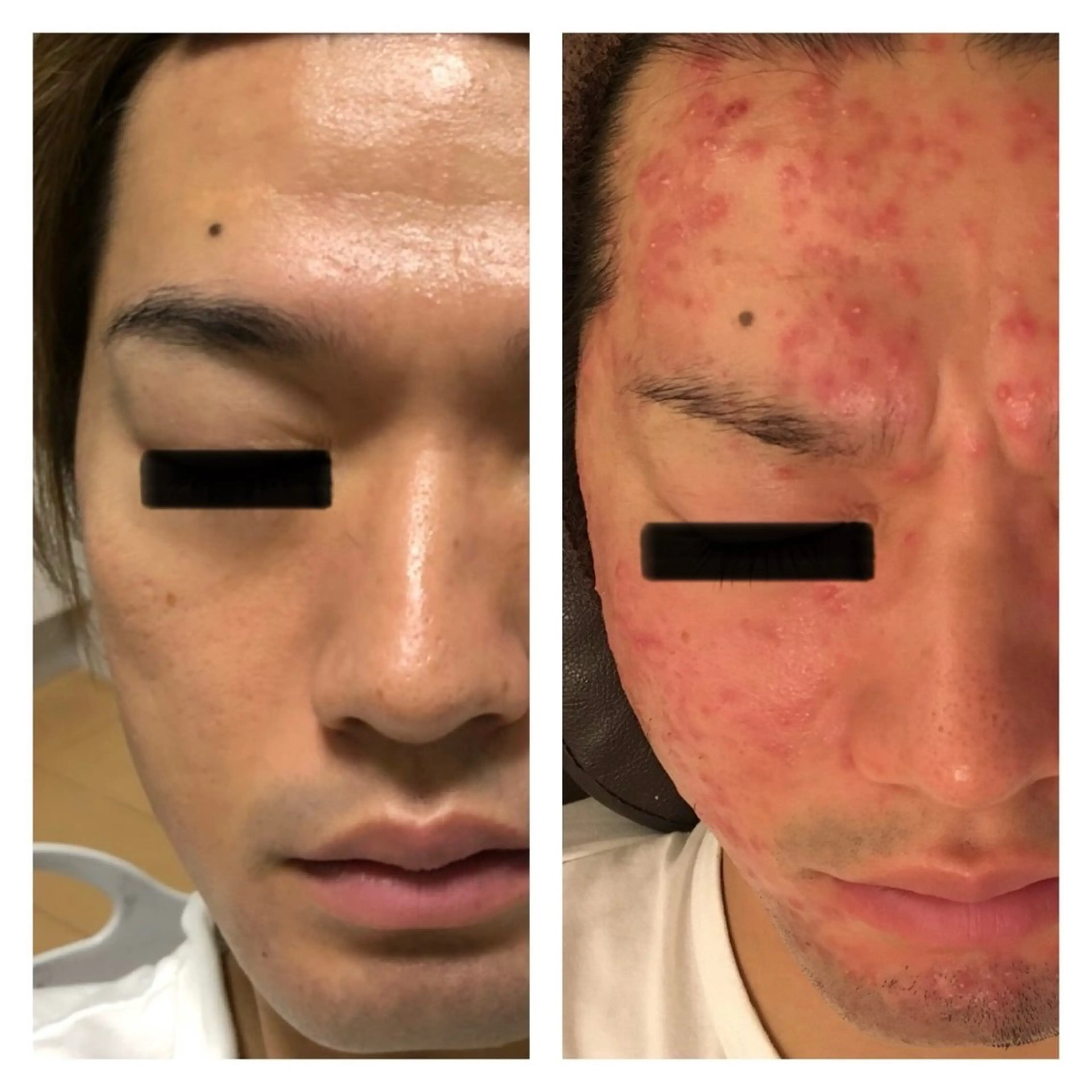 Lussera(ルセラ)所属・肌質を変えて すっぴん肌に✨のその他イメージ