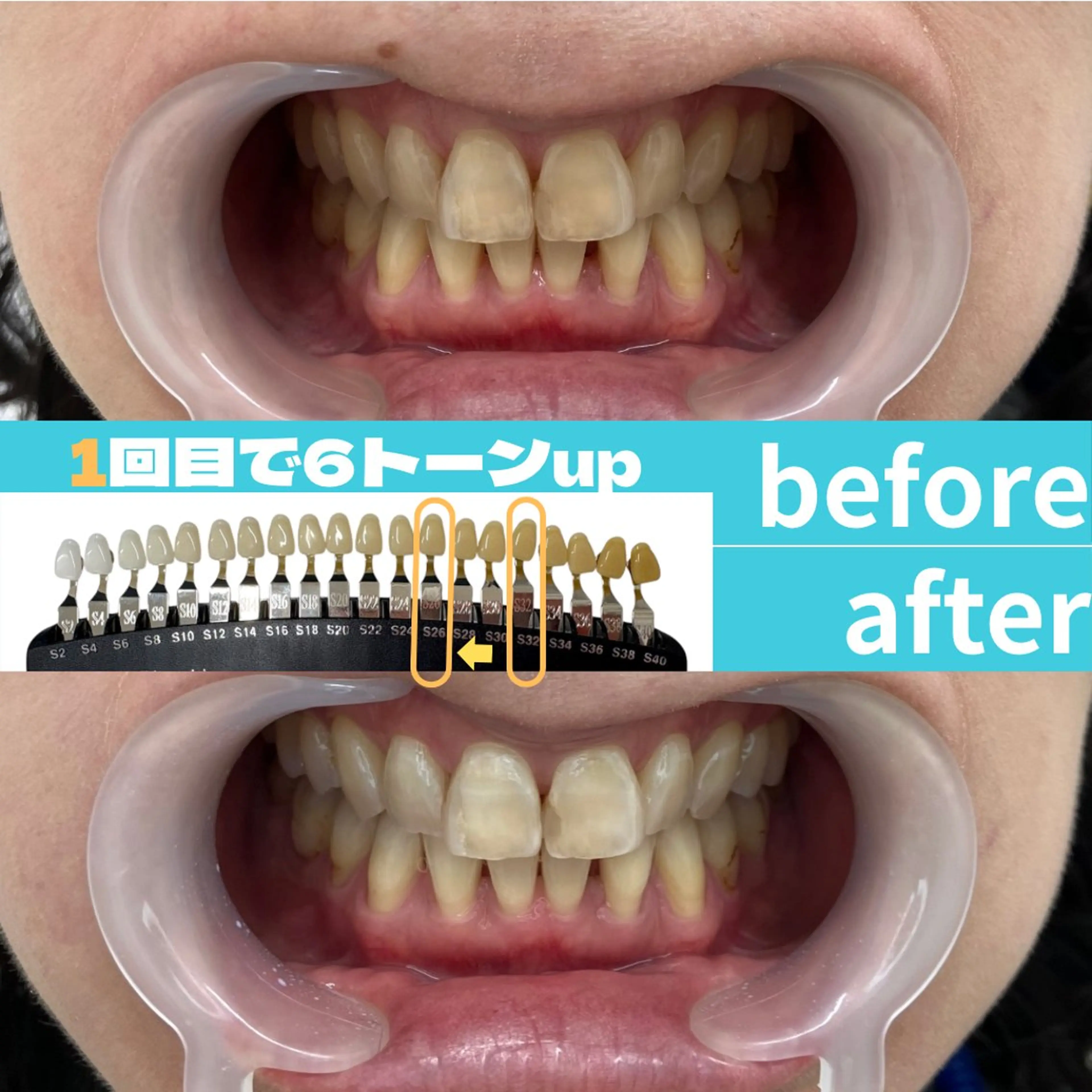 エステ s rikoのエステ・リラクイメージ