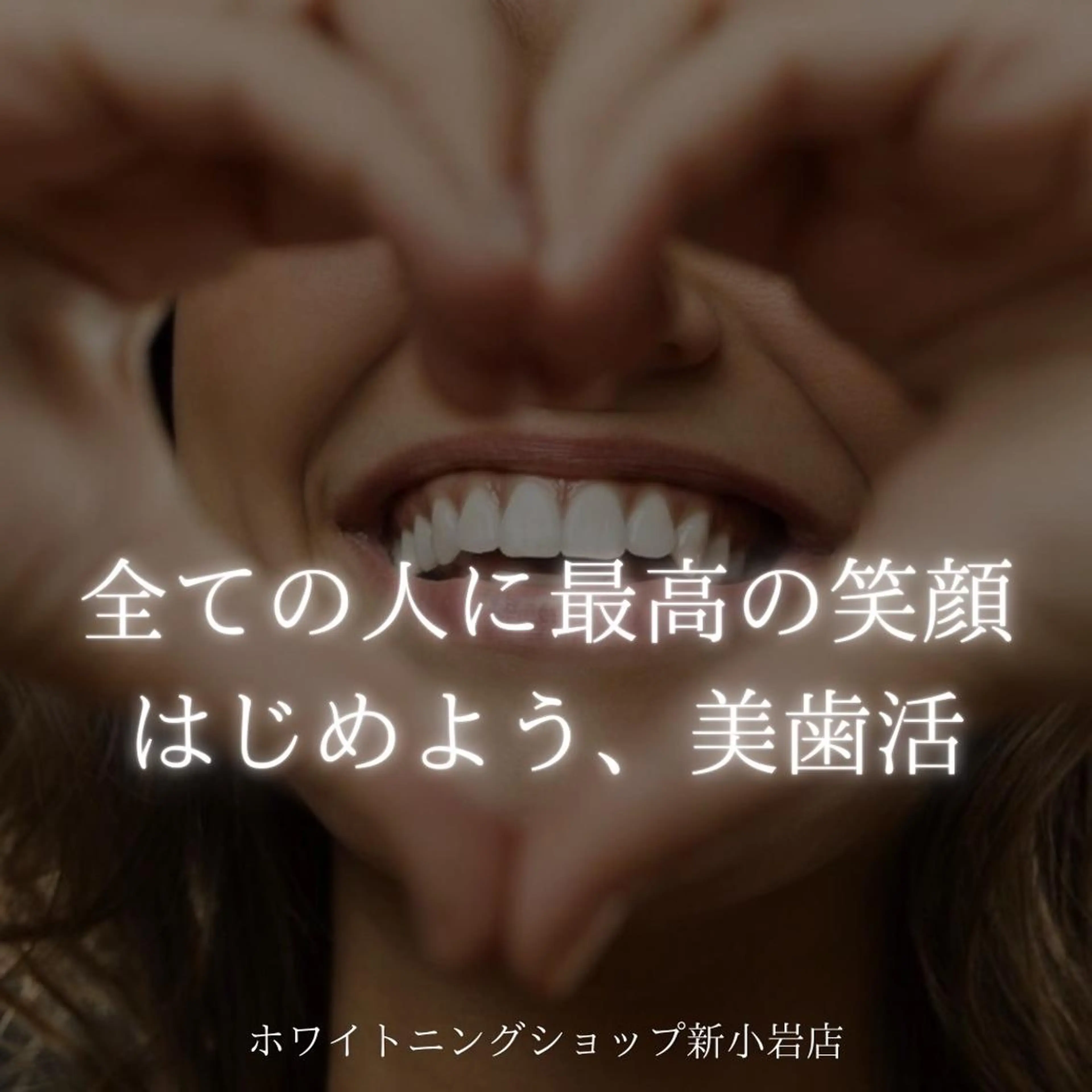 メンズ その他 ホワイトニング ショップ新小岩店のその他イメージ