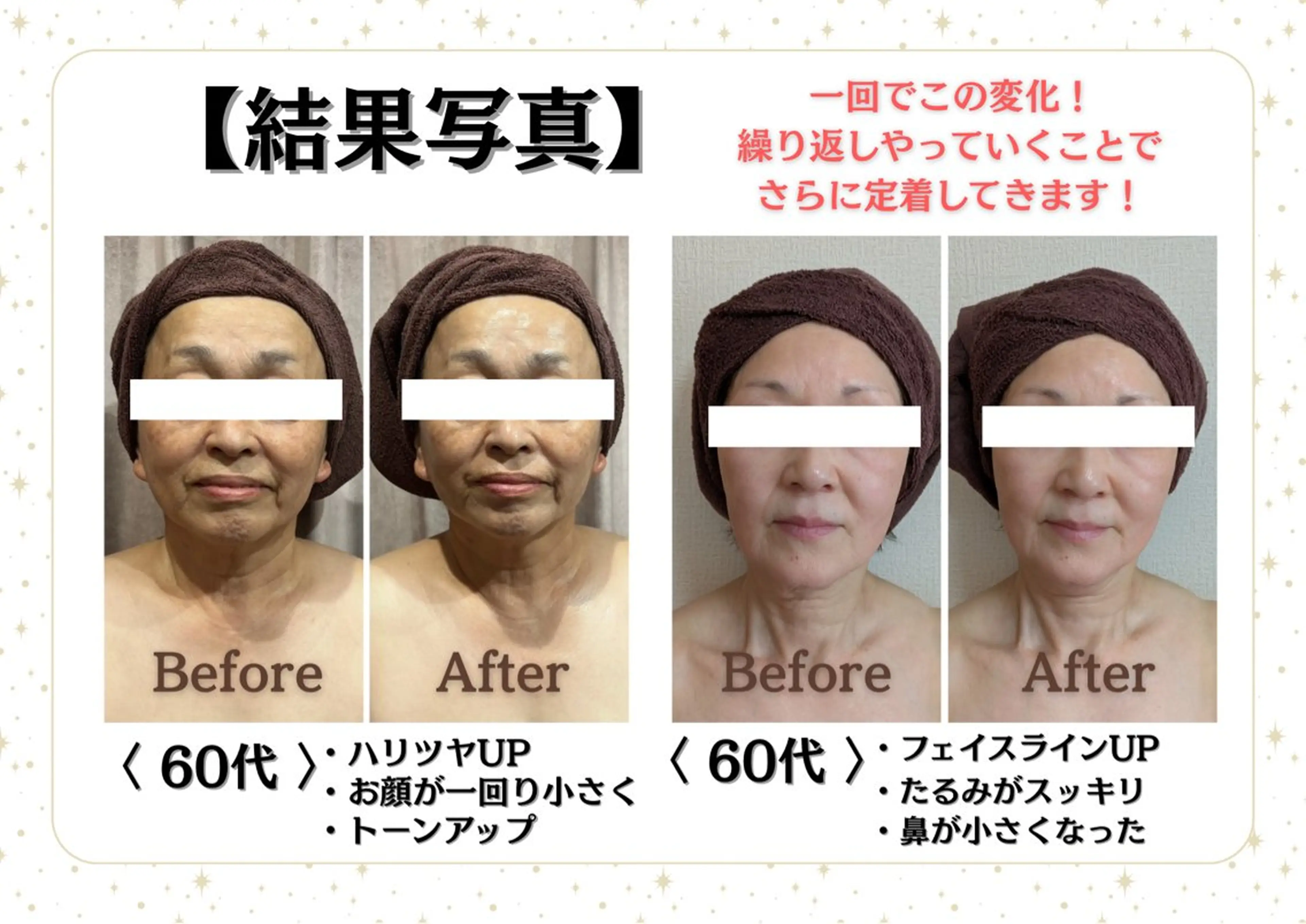 Eminy by  L★sのエステ・リラクイメージ