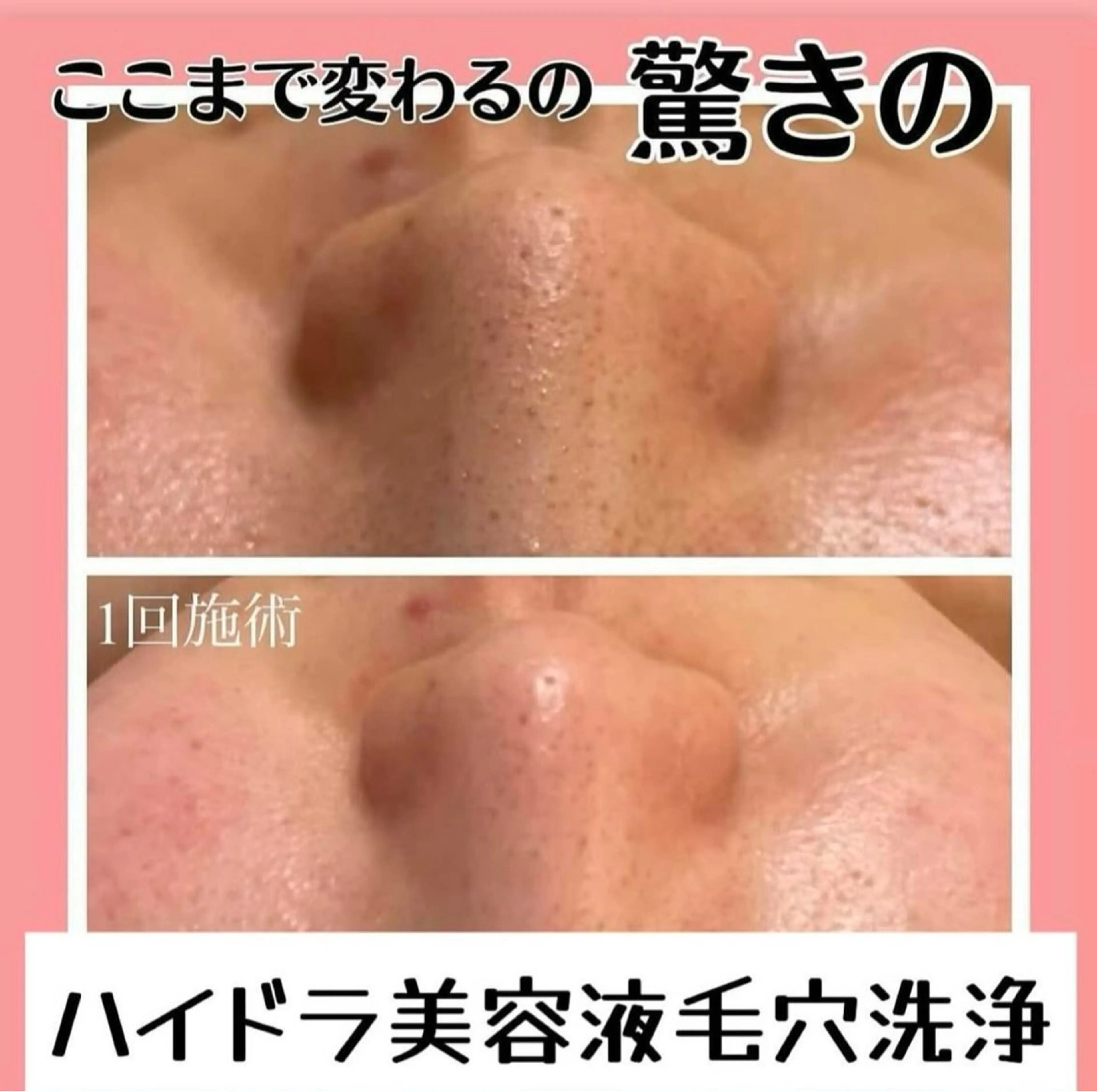 🦋肌改善 laule'a🦋のエステ・リラクイメージ