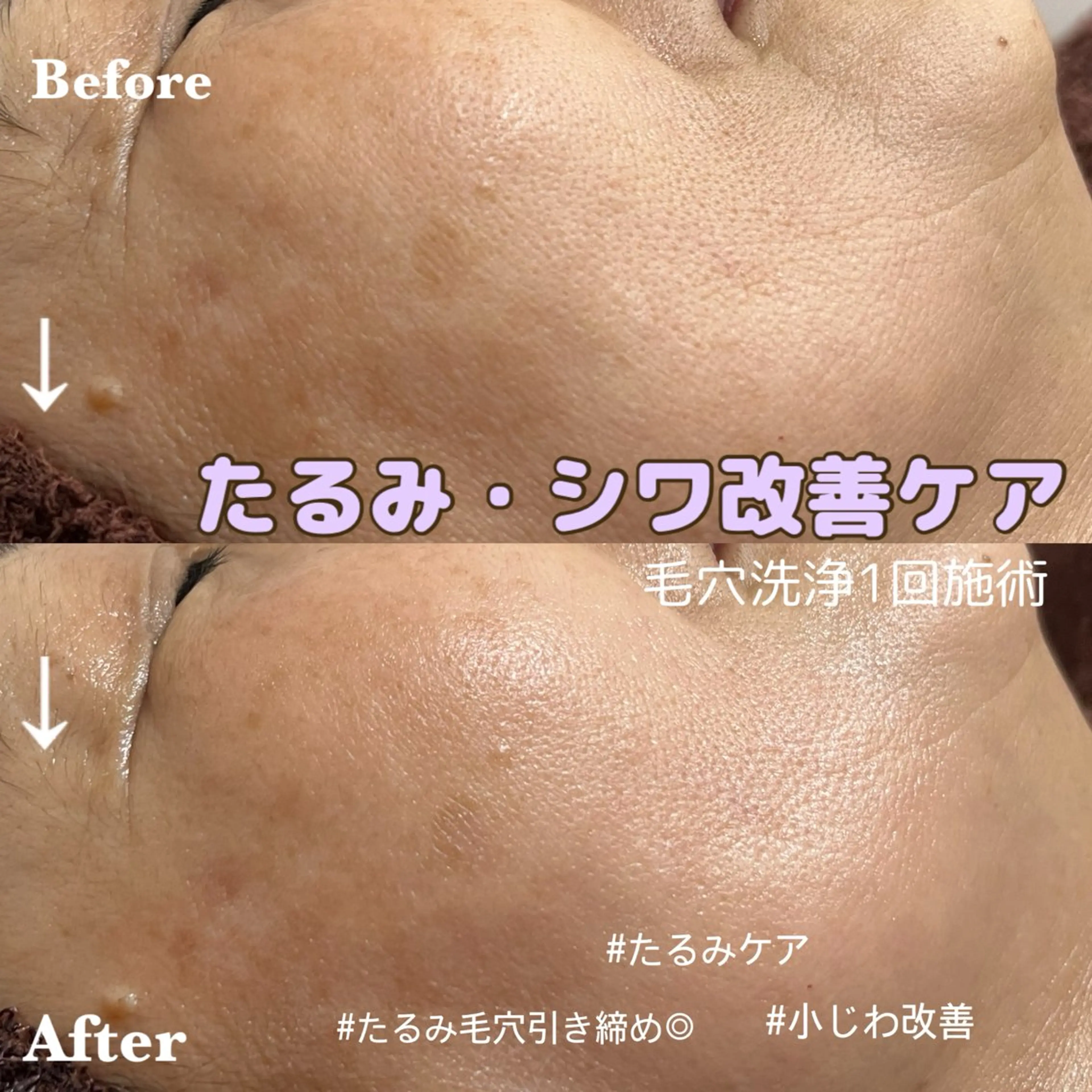 MINOA  大野城店所属・小林 千愛のエステ・リラクイメージ