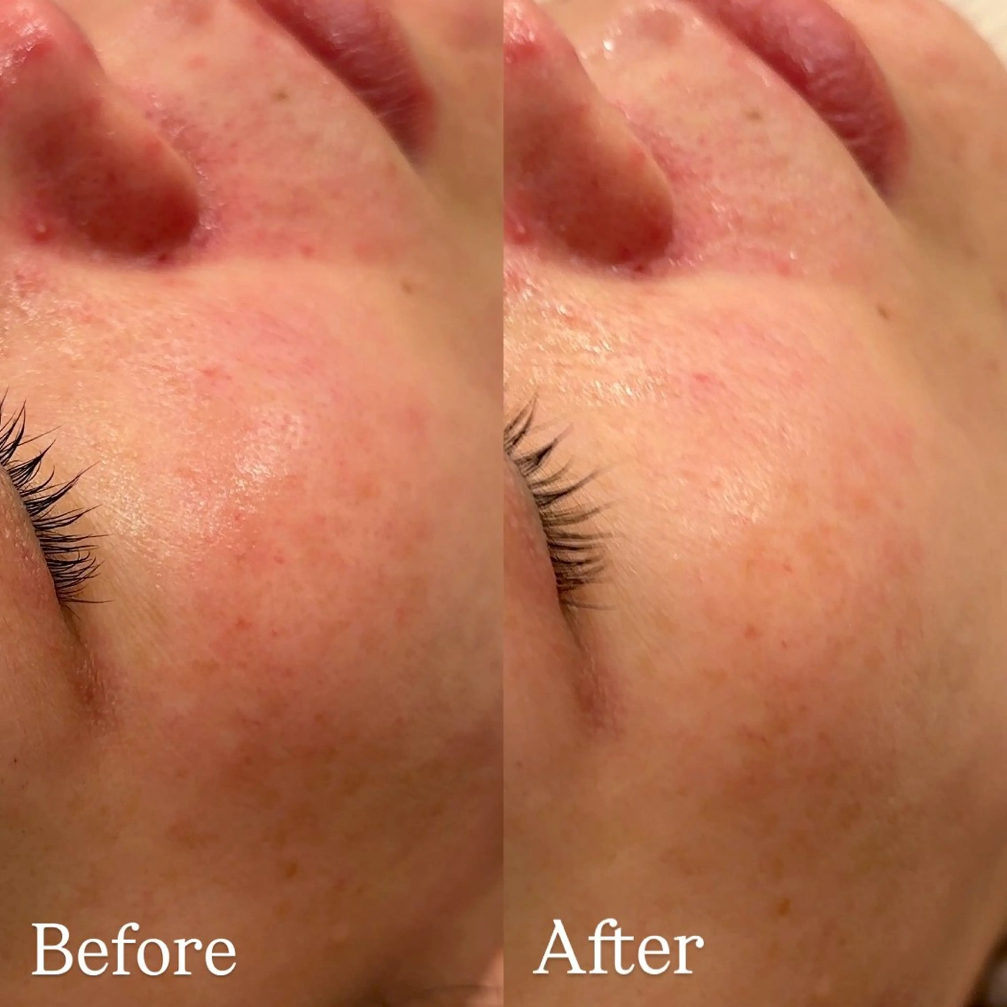 Hari Lounge恵比寿所属・chika🦋 ハリラウンジ恵比寿のエステ・リラクイメージ