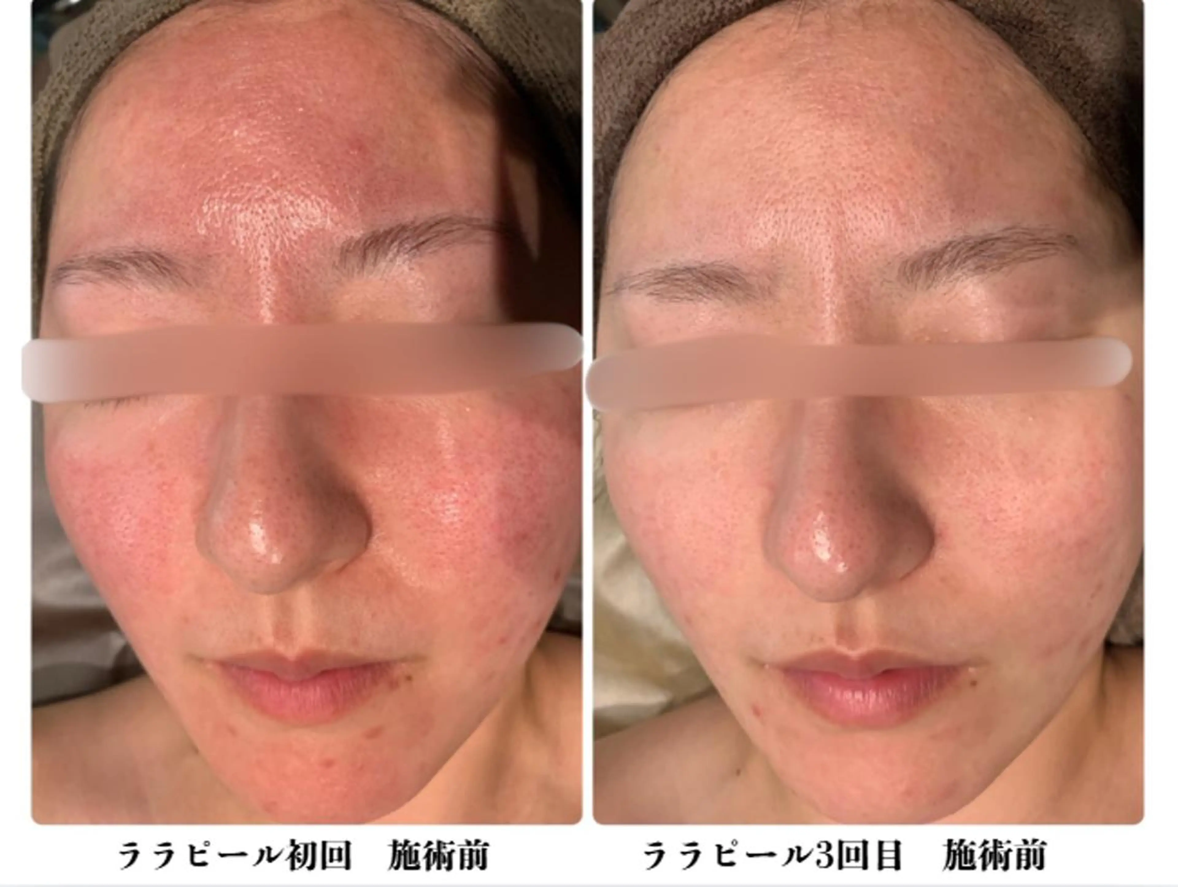 クリニック認定サロン FREYAのエステ・リラクイメージ