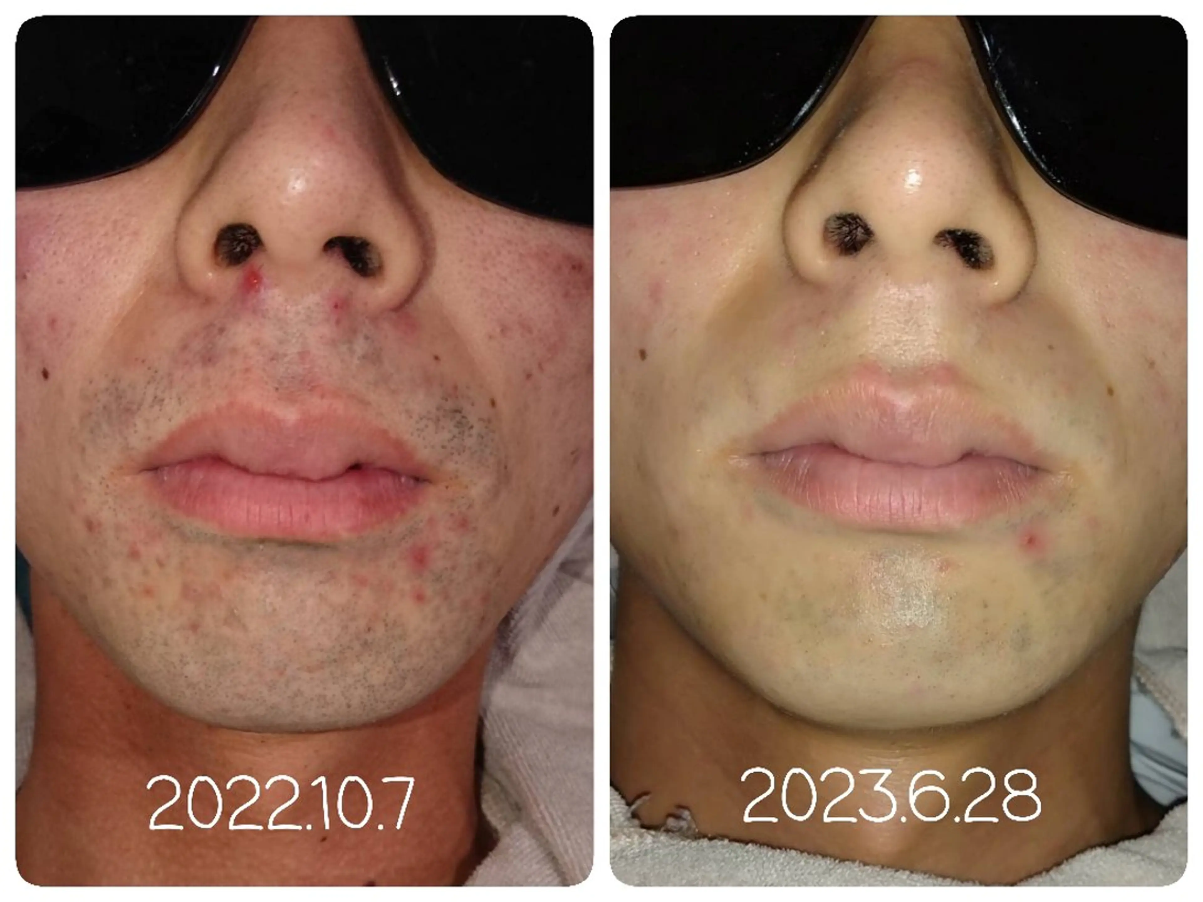 プライベートサロンマリン所属・Private Sa lon MARINEのエステ・リラクイメージ