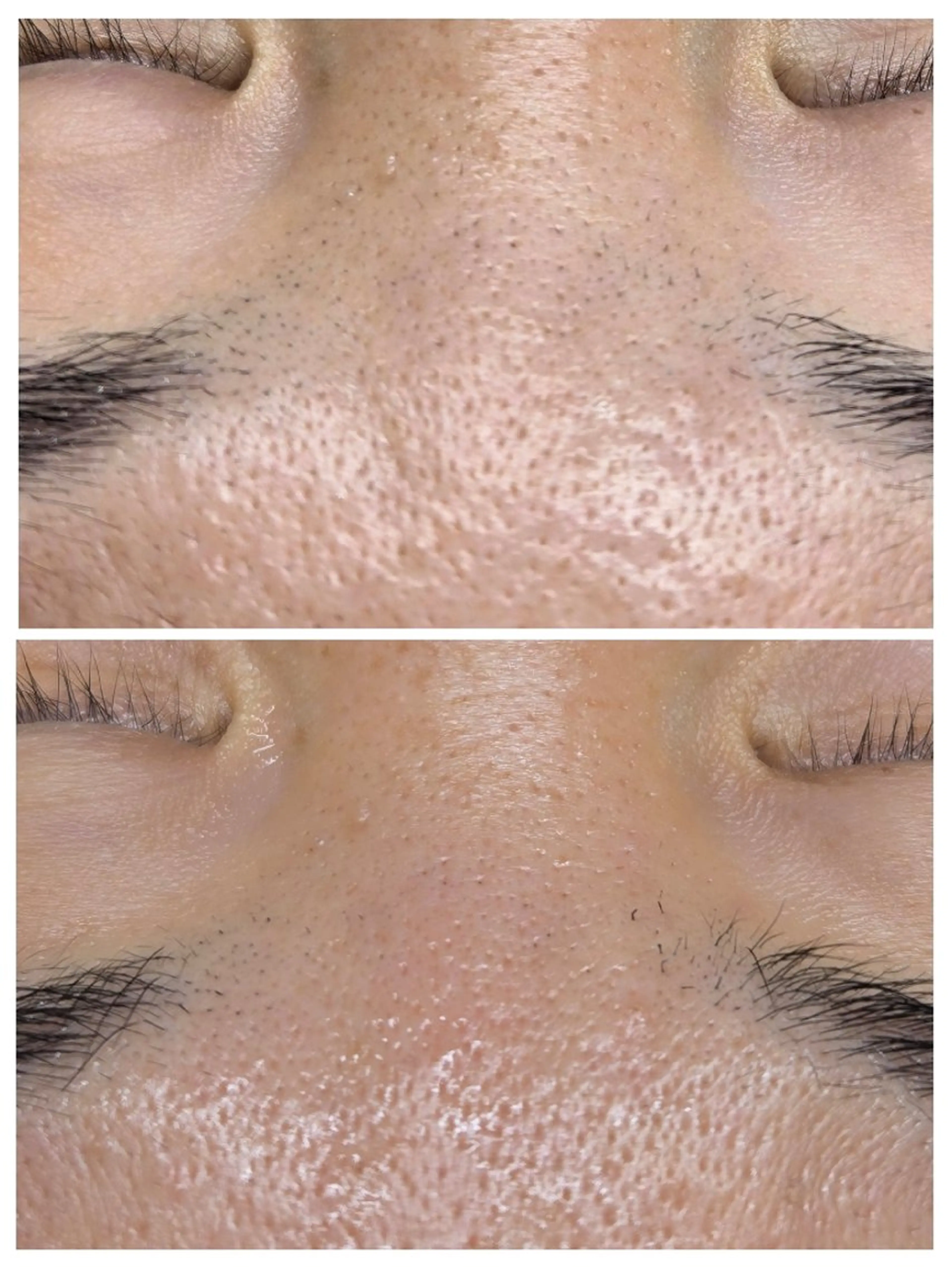 フェイシャルワックス GLOW所属・渡邊 真依のエステ・リラクイメージ