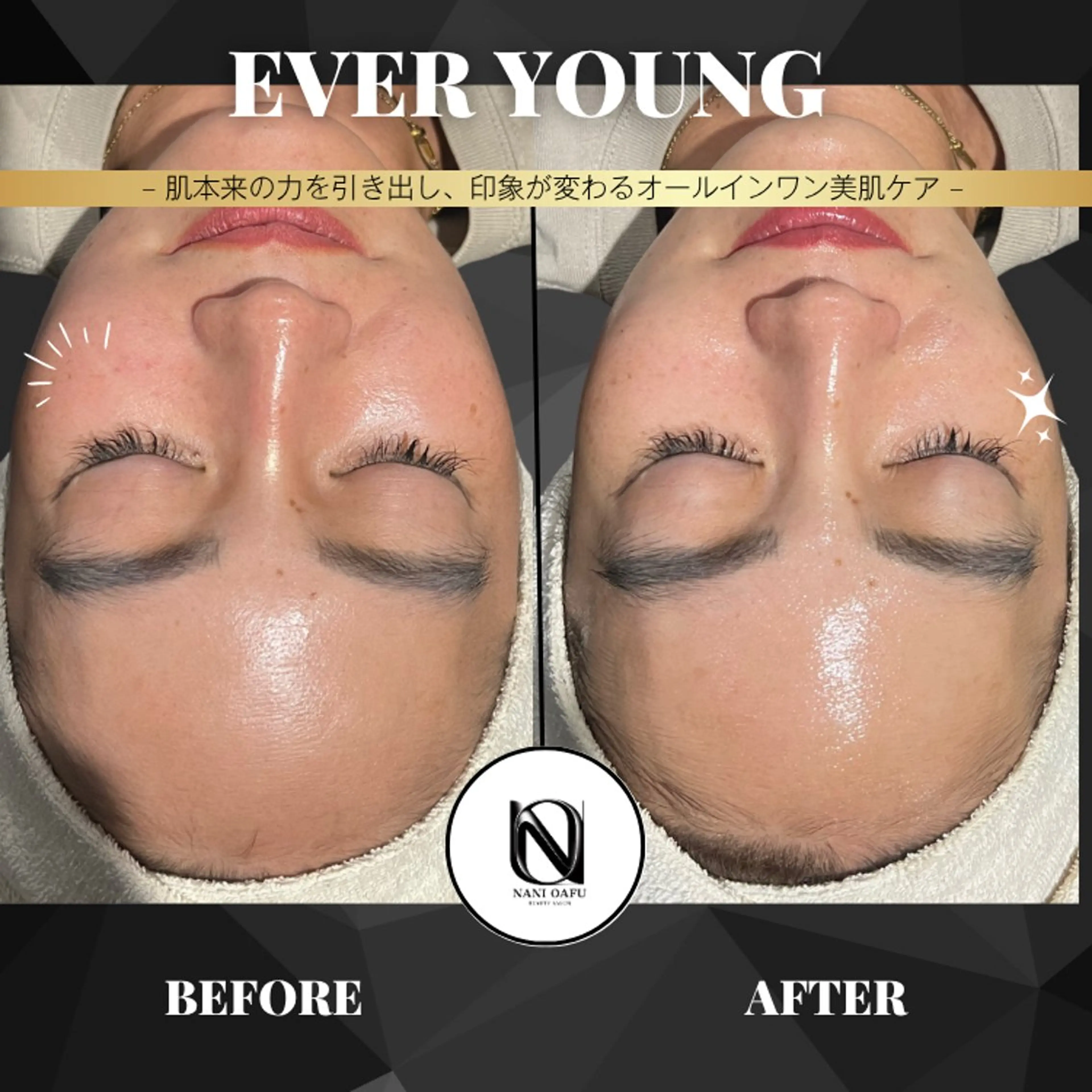 【✨1回で肌印象UP】EVER YOUNG|うるおい・ハリ・毛穴ケアをまとめてサポート〈メンズOK〉の写真