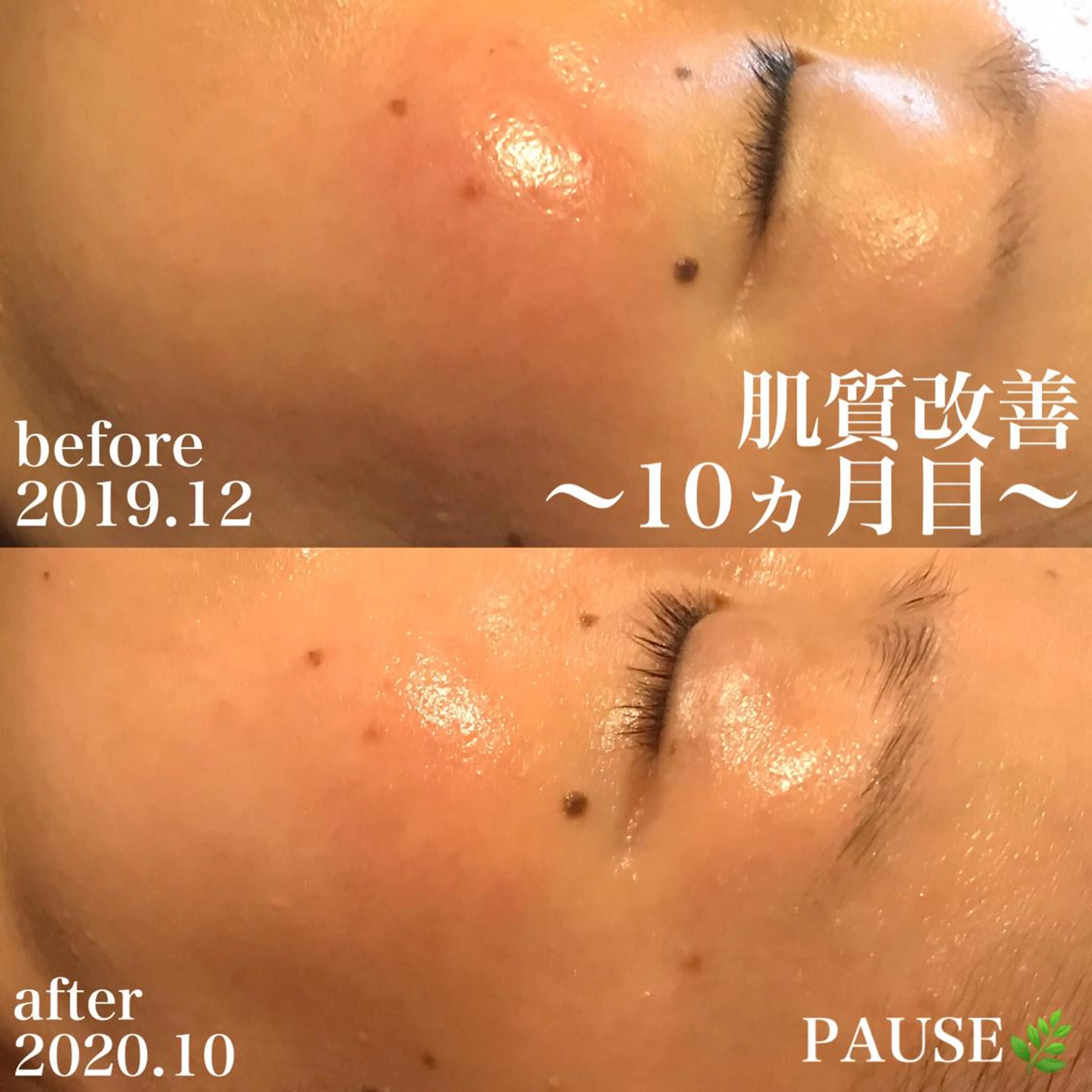 エステ リラク 浜野 恵美のエステ・リラクイメージ