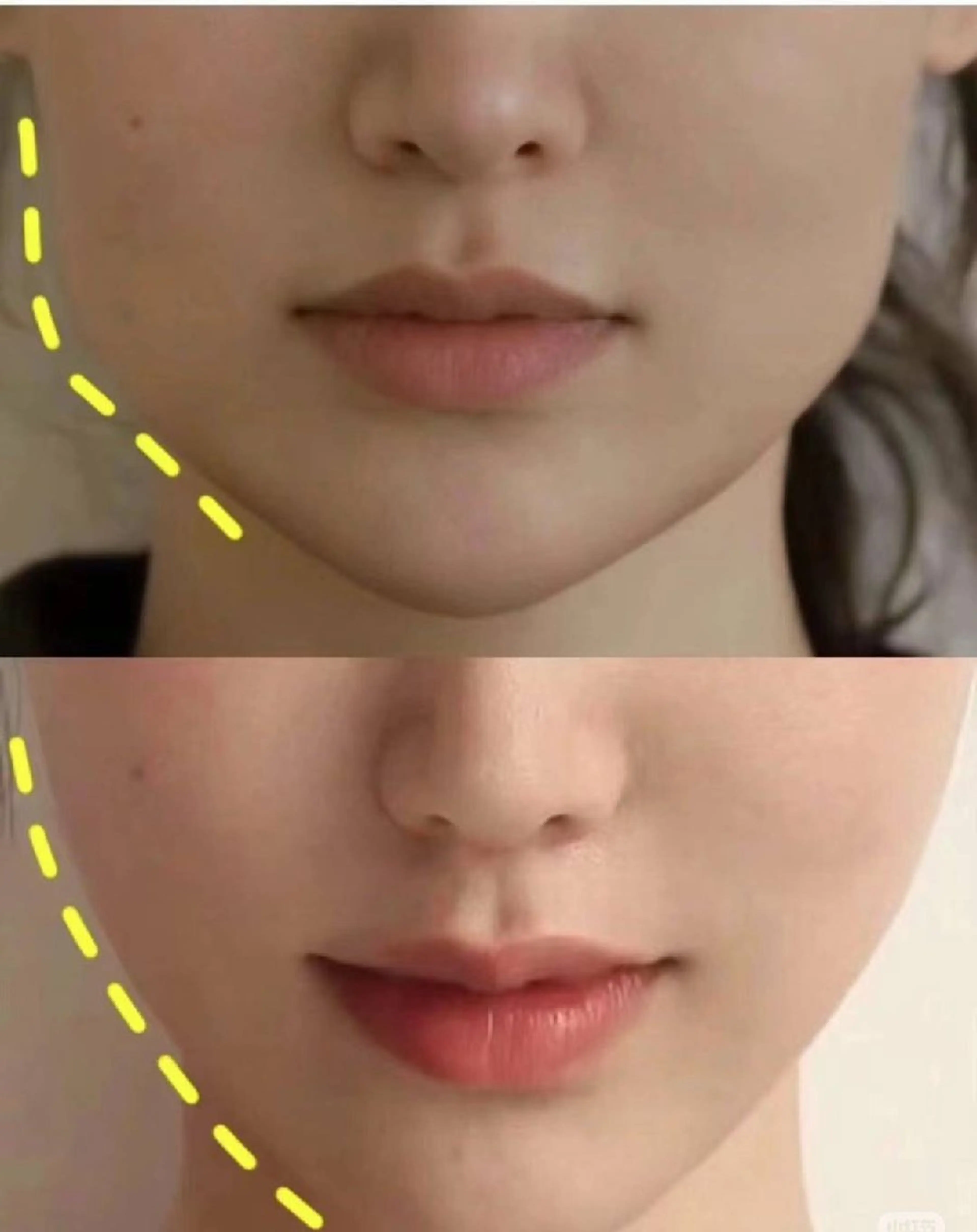 aliaハイフ&水光ジェットサロン所属・aliaハーブ水光店 エステティシャン募集のエステ・リラクイメージ